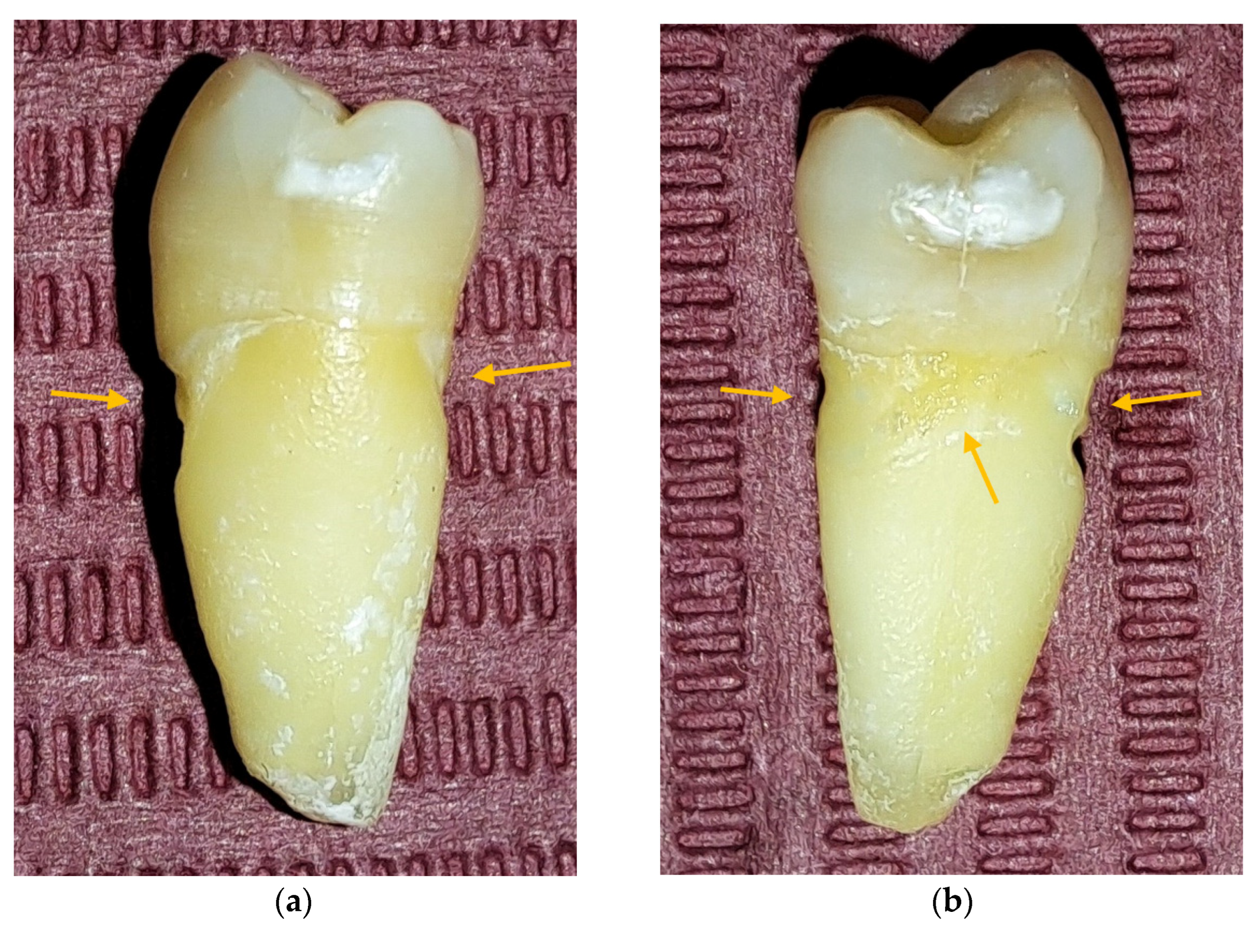 Jpm 13 00772 g002 Jpm 13 00772 g002