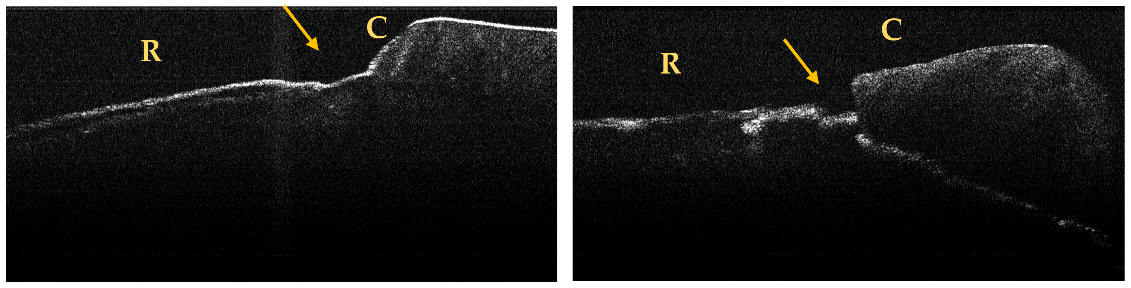 Jpm 13 00772 g005 Jpm 13 00772 g005