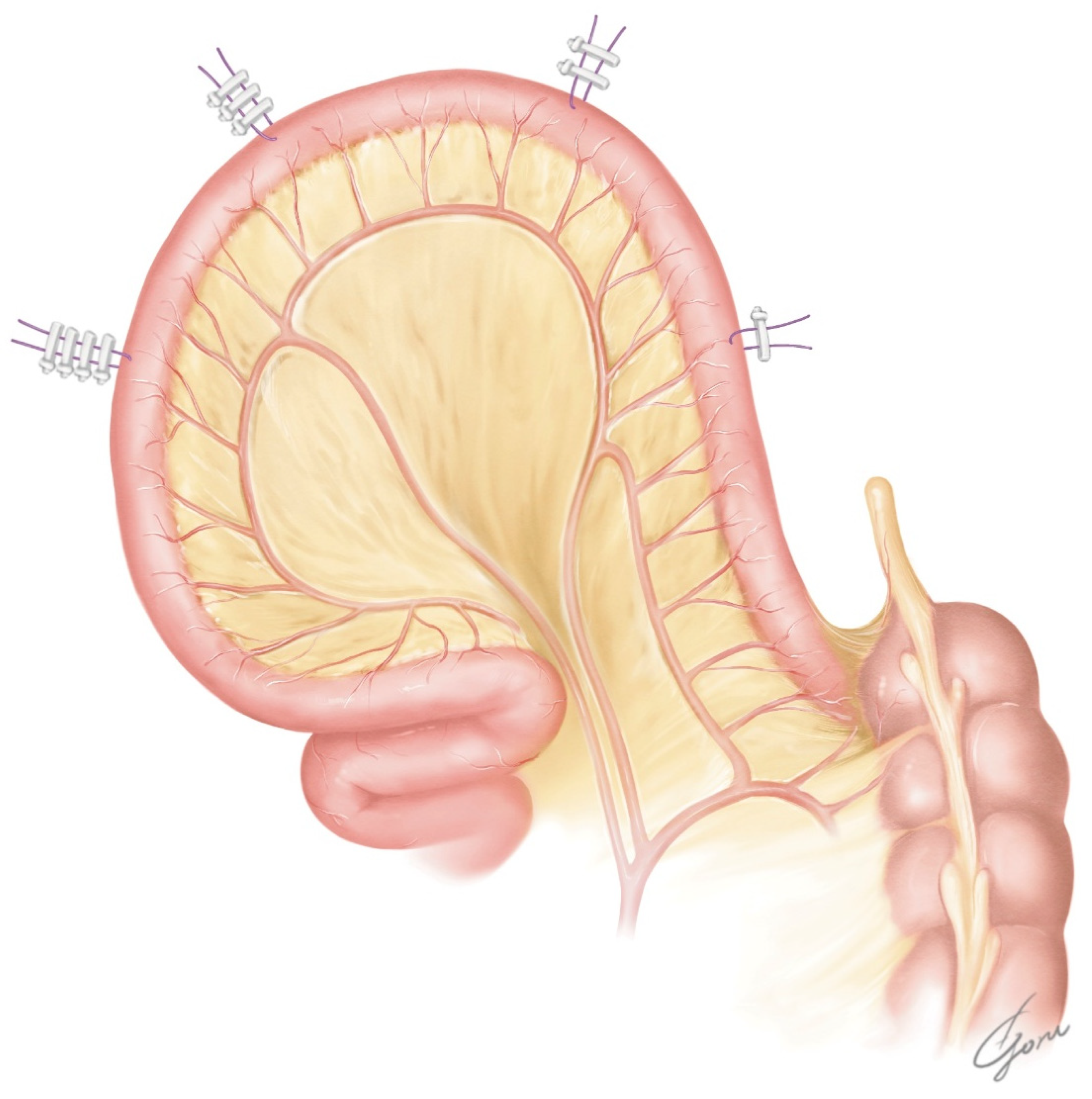 Jpm 13 00802 g001 Jpm 13 00802 g001