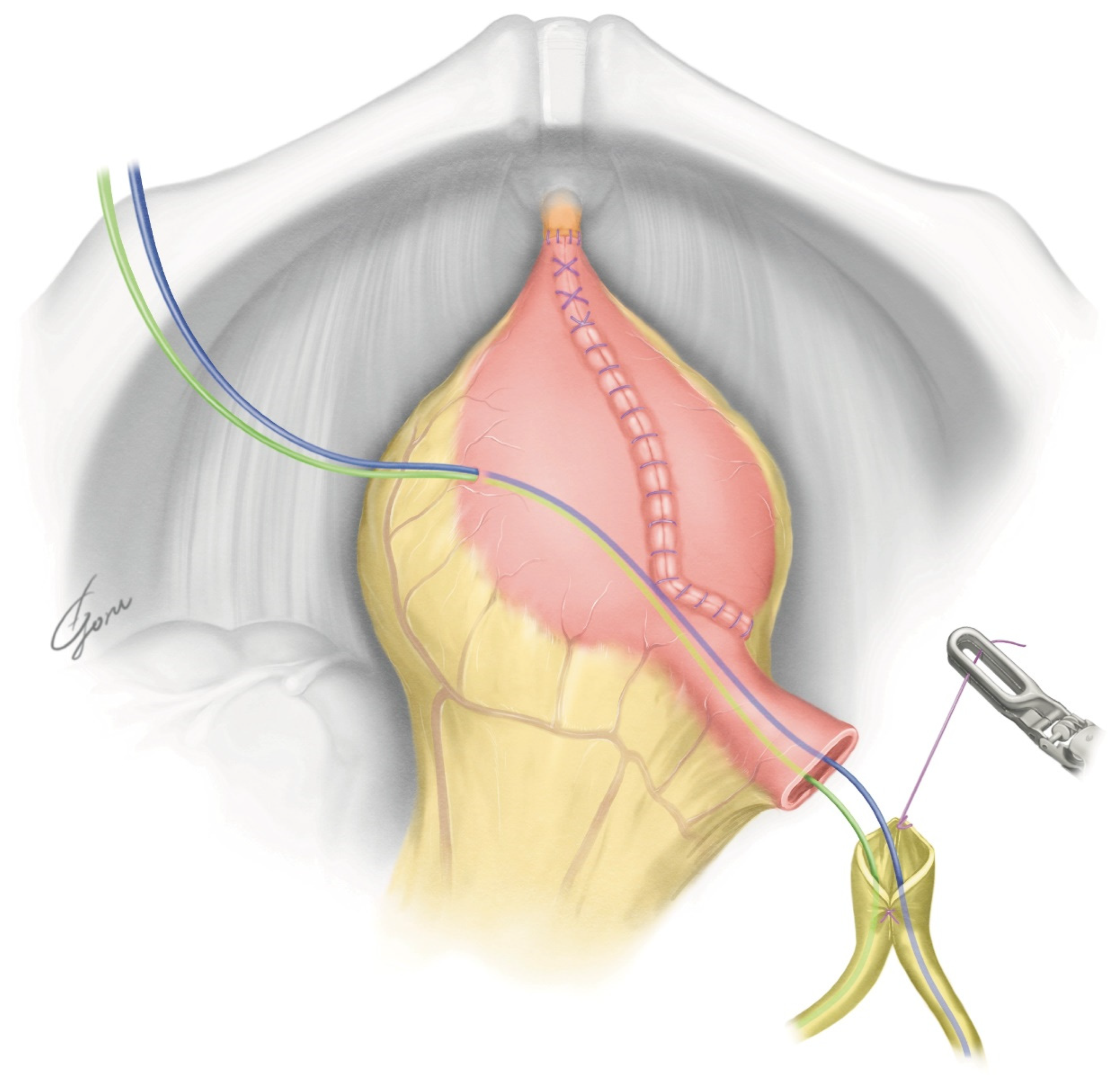 Jpm 13 00802 g004 Jpm 13 00802 g004