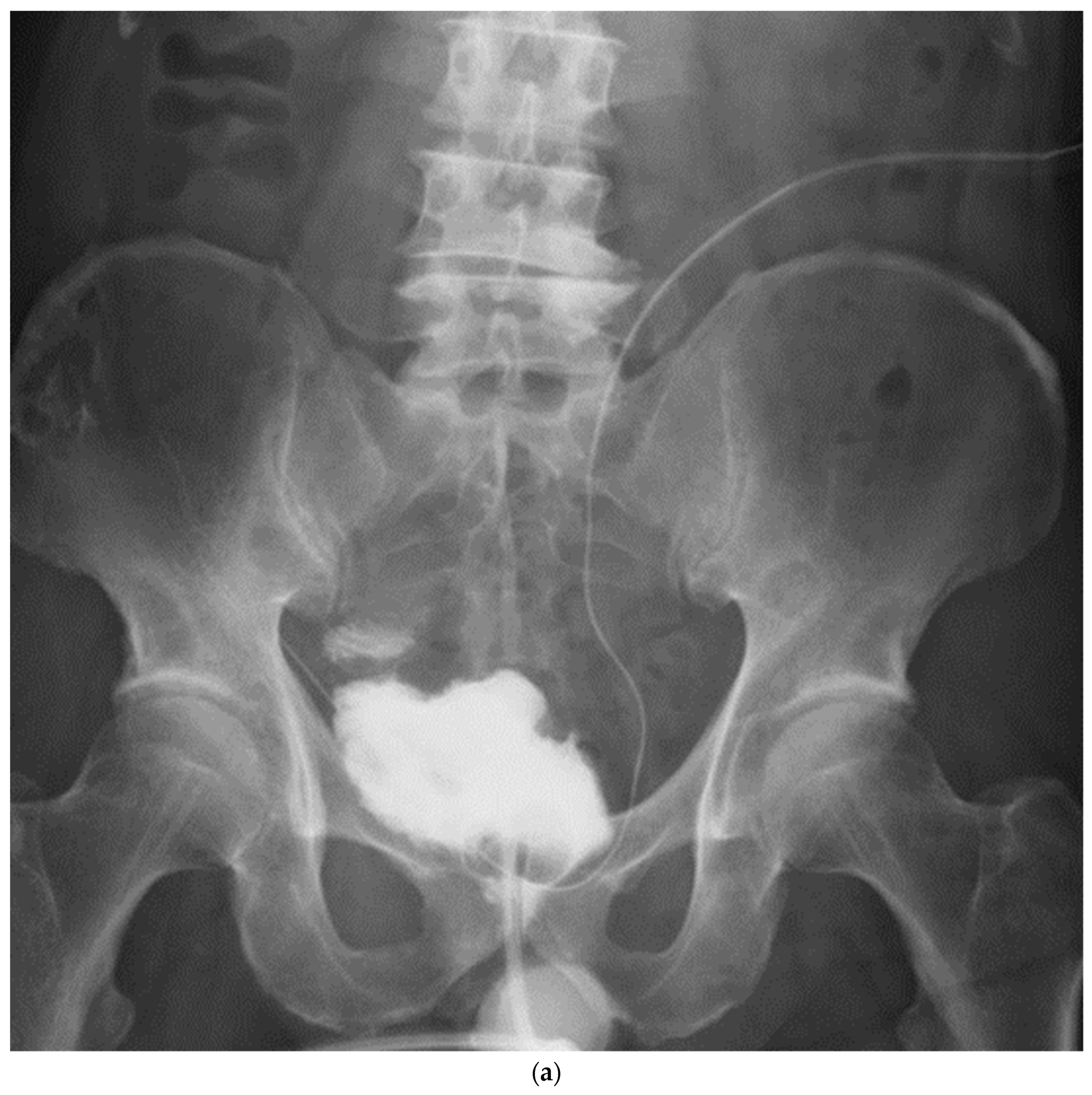 Jpm 13 00802 g005a Jpm 13 00802 g005a