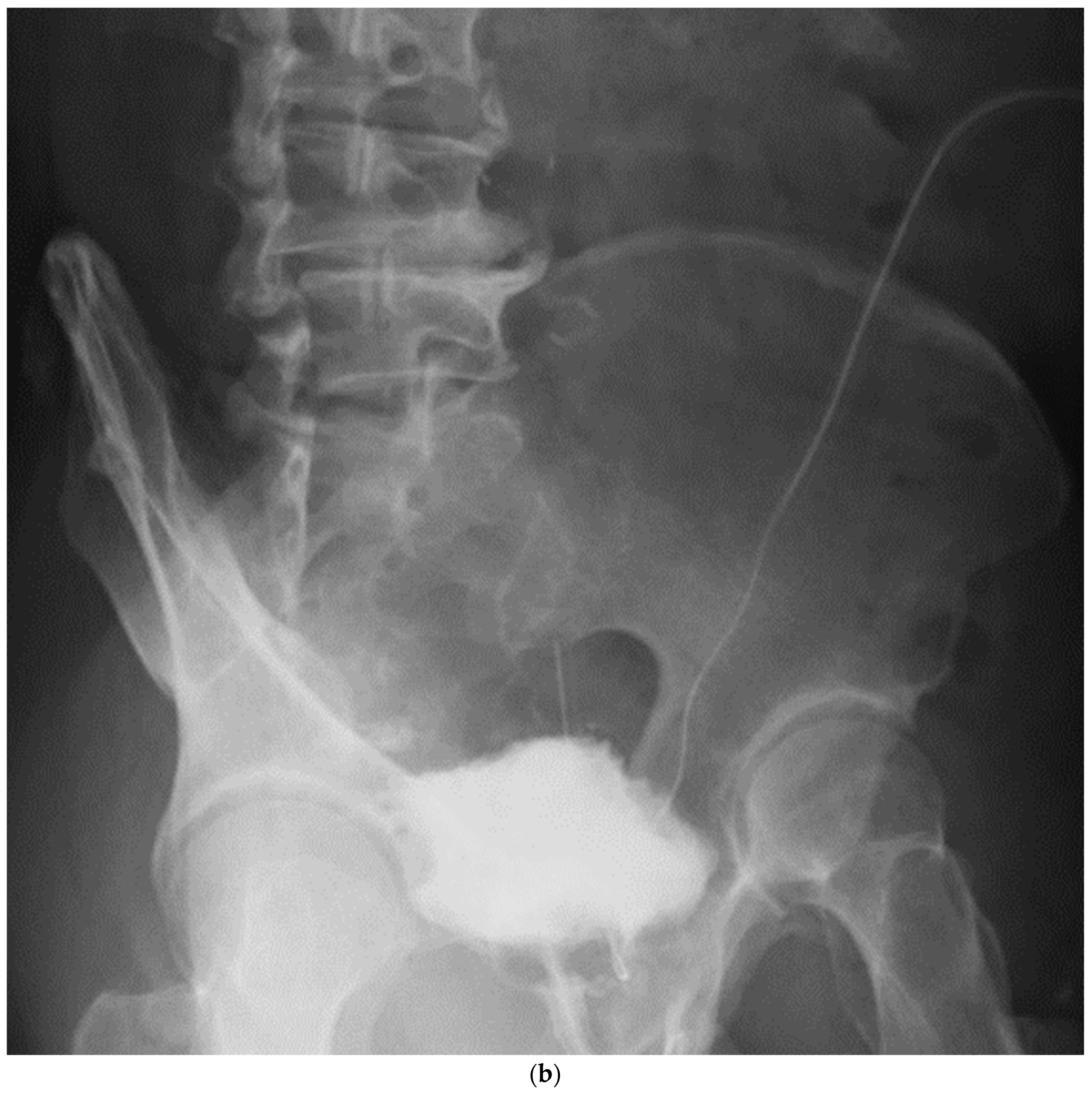 Jpm 13 00802 g005b Jpm 13 00802 g005b