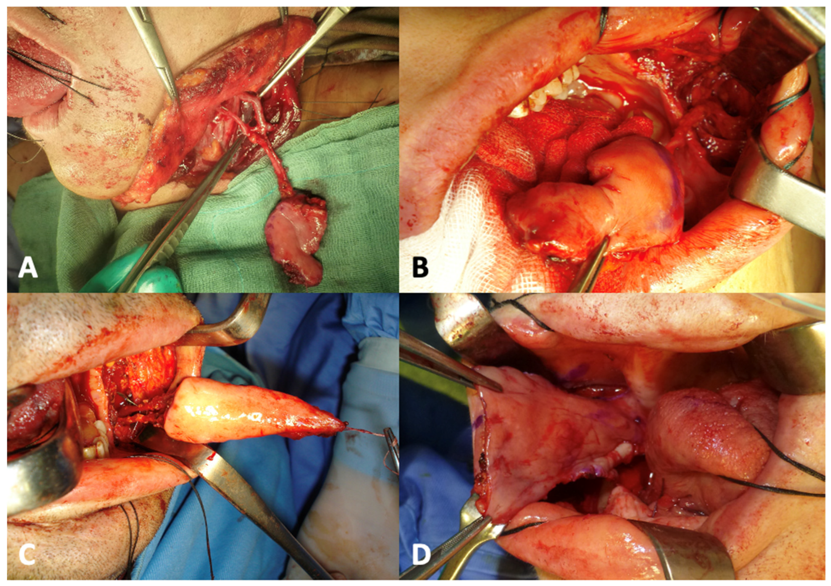 Jpm 13 00879 g001 Jpm 13 00879 g001