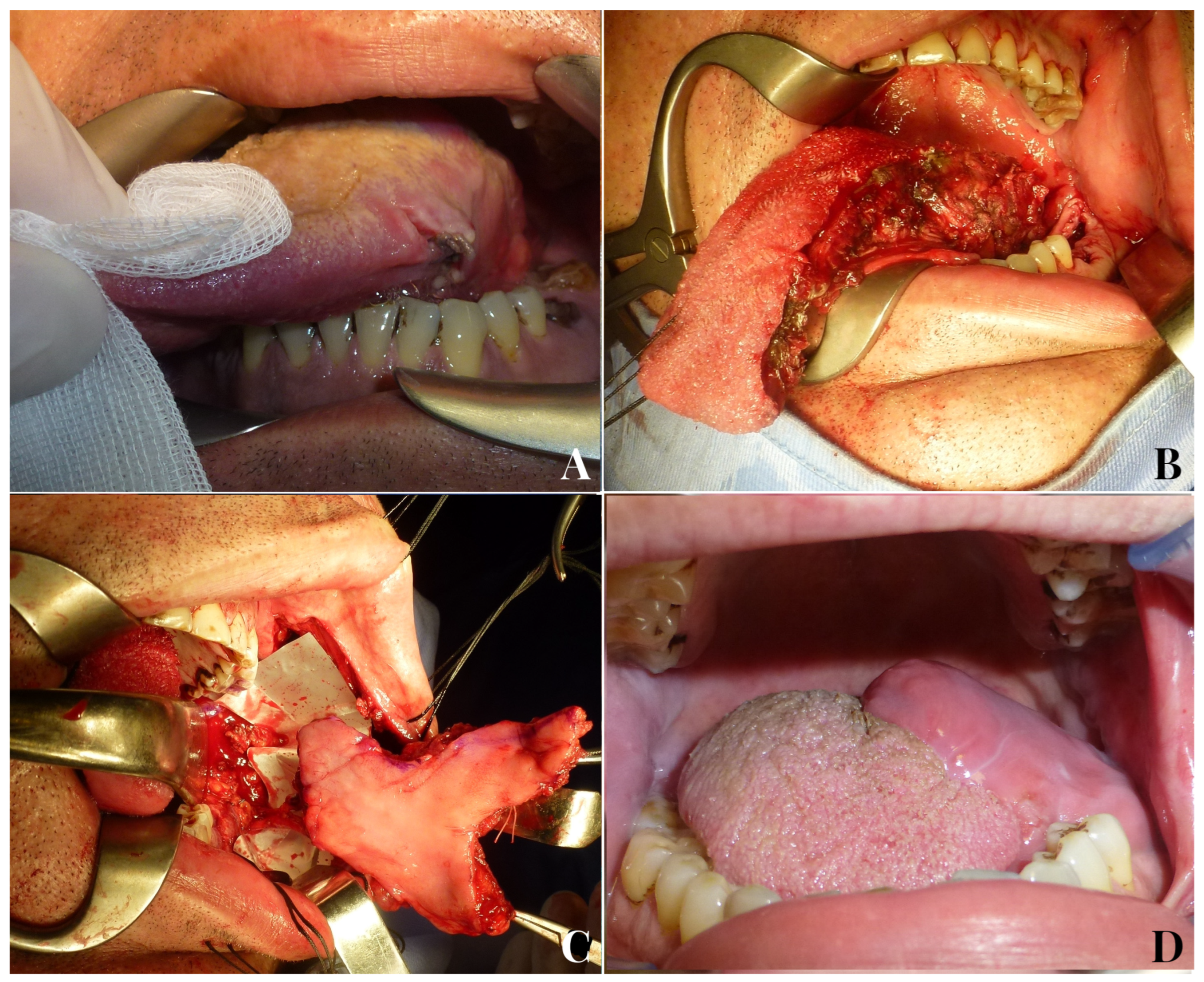 Jpm 13 00879 g003 Jpm 13 00879 g003