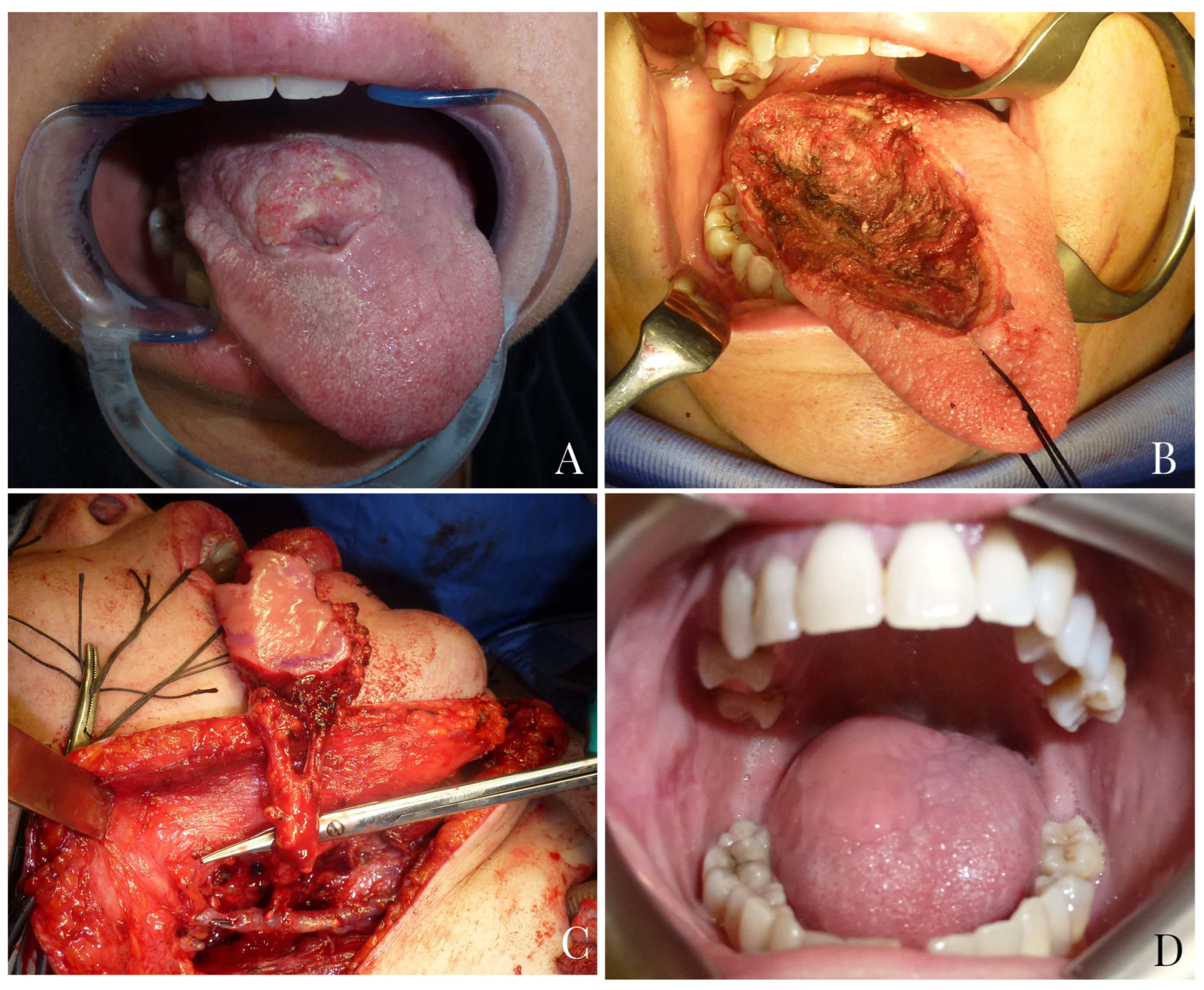 Jpm 13 00879 g004 Jpm 13 00879 g004