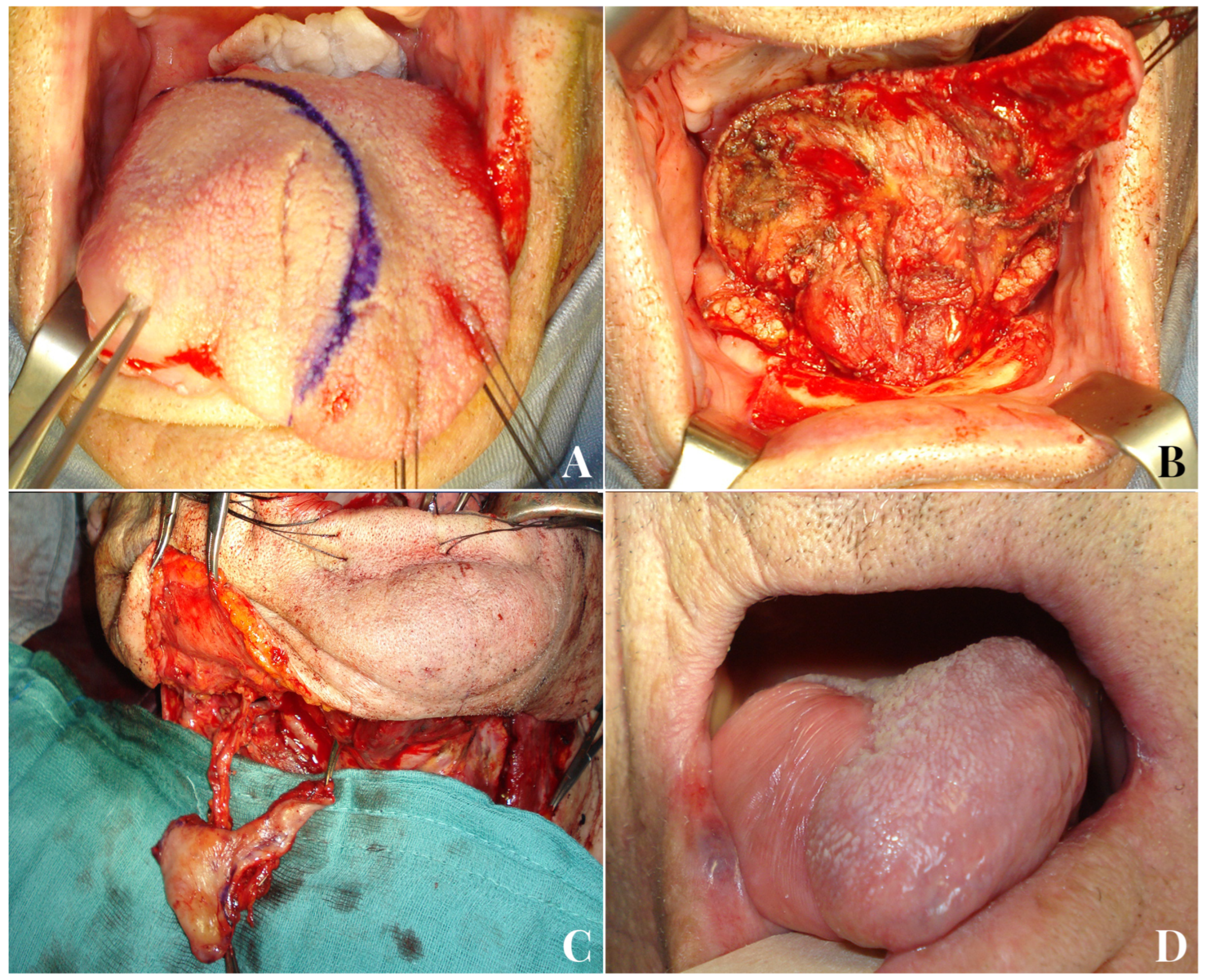 Jpm 13 00879 g005 Jpm 13 00879 g005