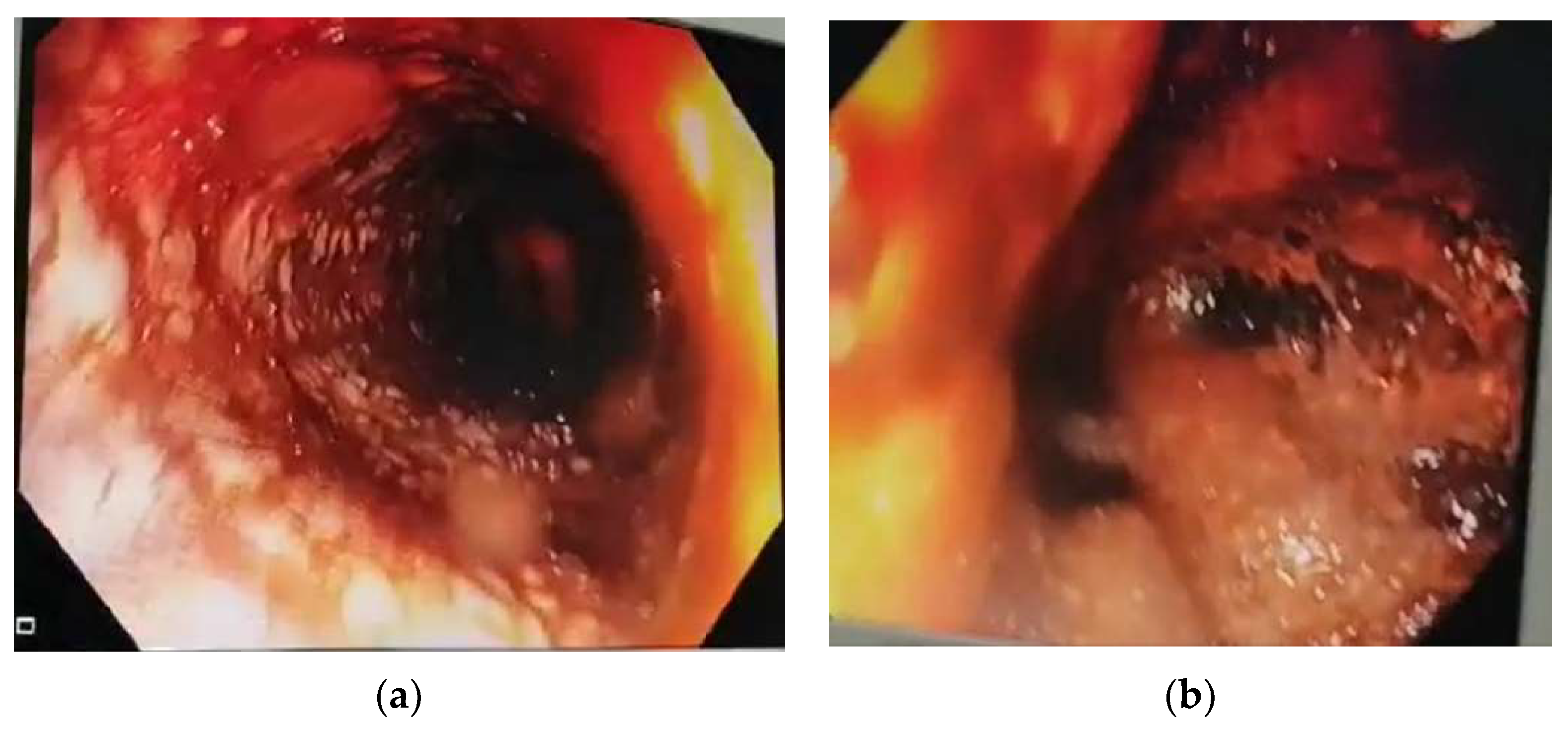 Jpm 13 00987 g001 Jpm 13 00987 g001