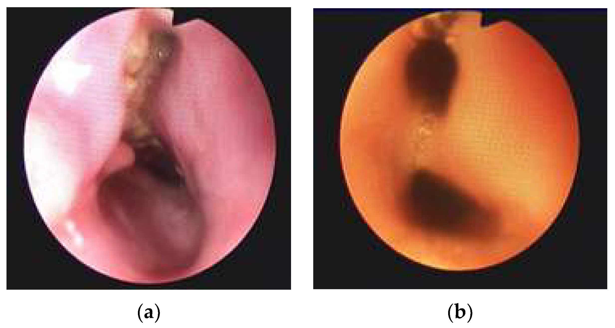 Jpm 13 00987 g002 Jpm 13 00987 g002