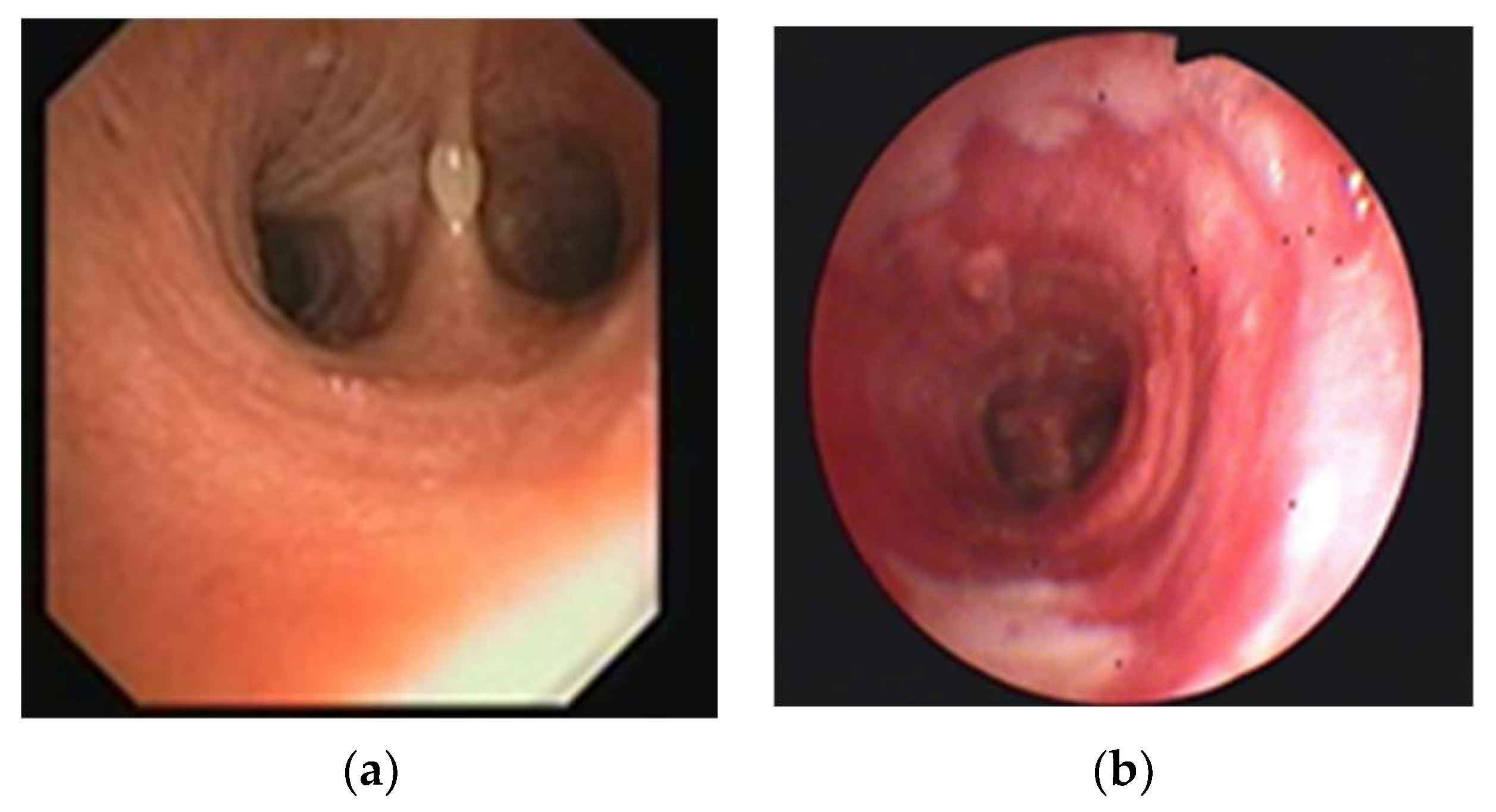 Jpm 13 00987 g003 Jpm 13 00987 g003