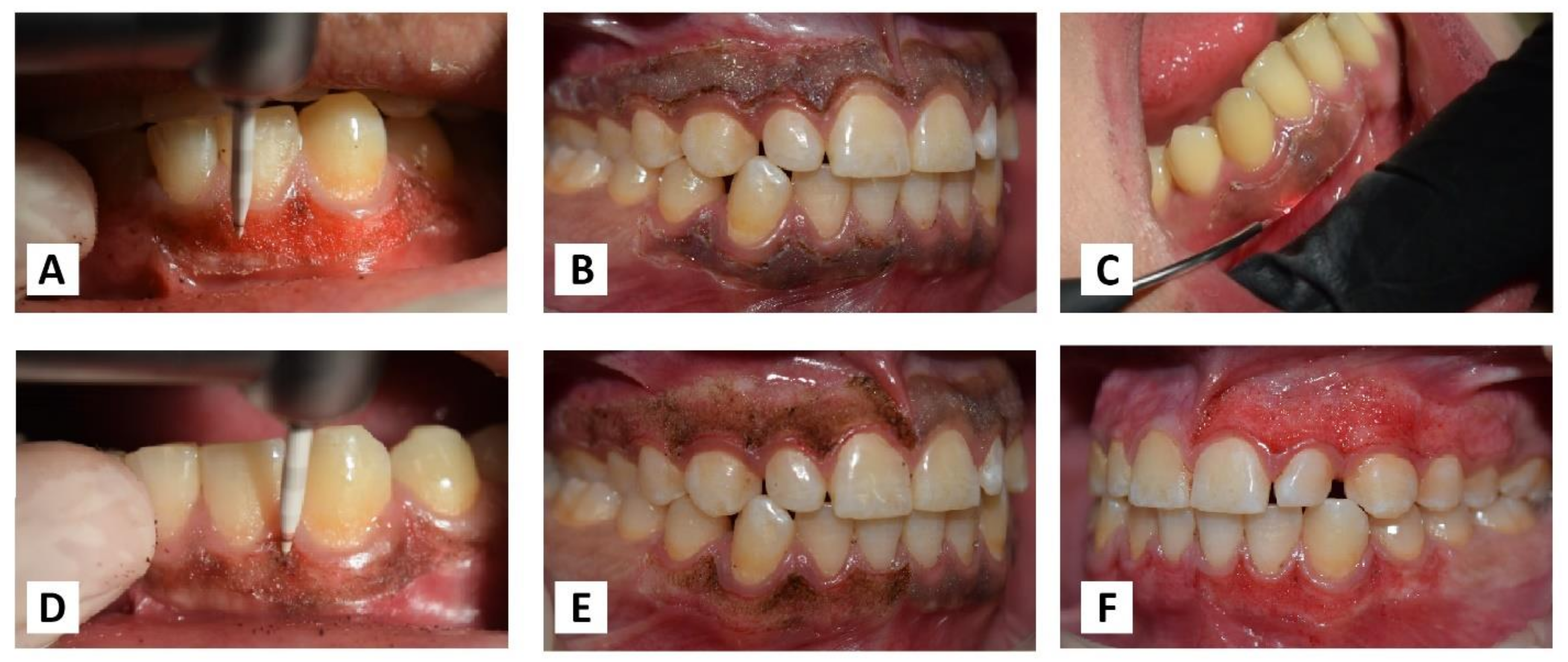 Jpm 13 01034 g002 Jpm 13 01034 g002