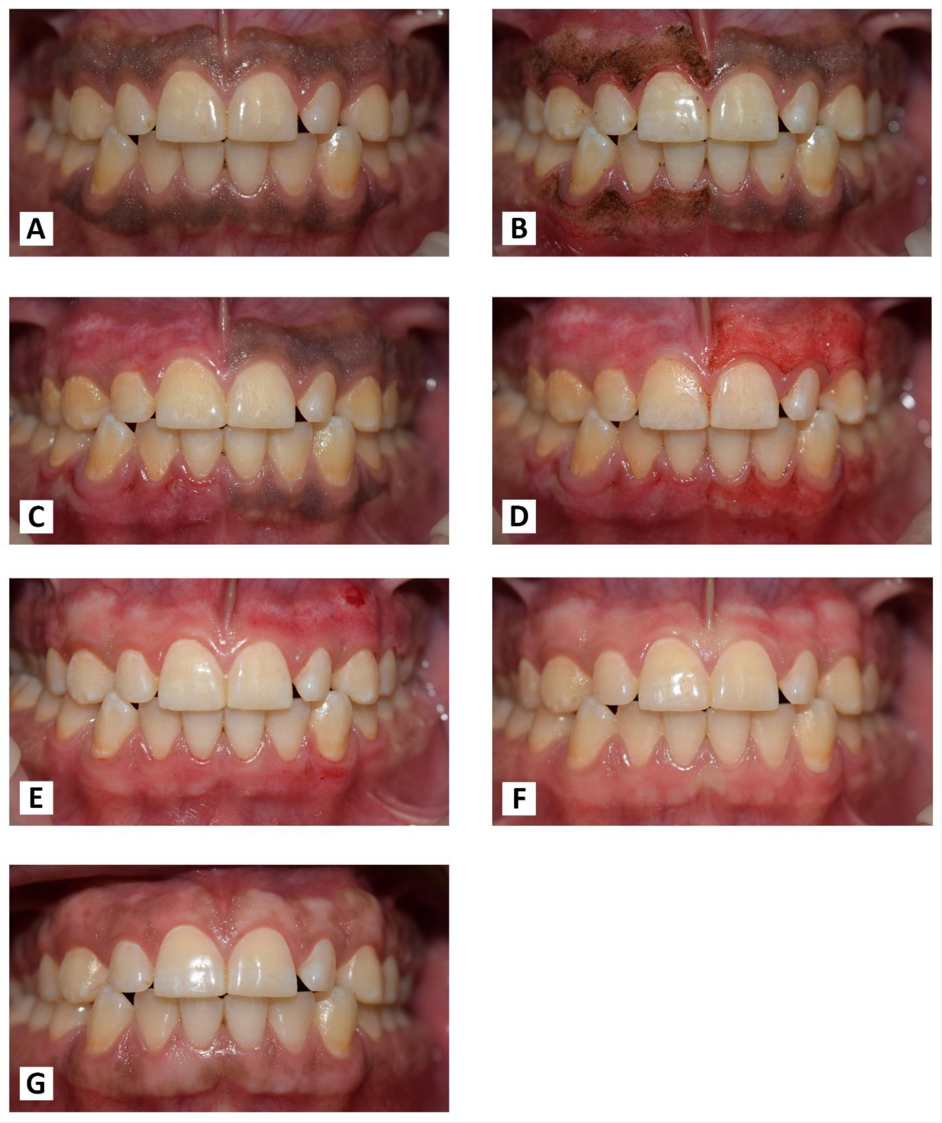 Jpm 13 01034 g011 Jpm 13 01034 g011
