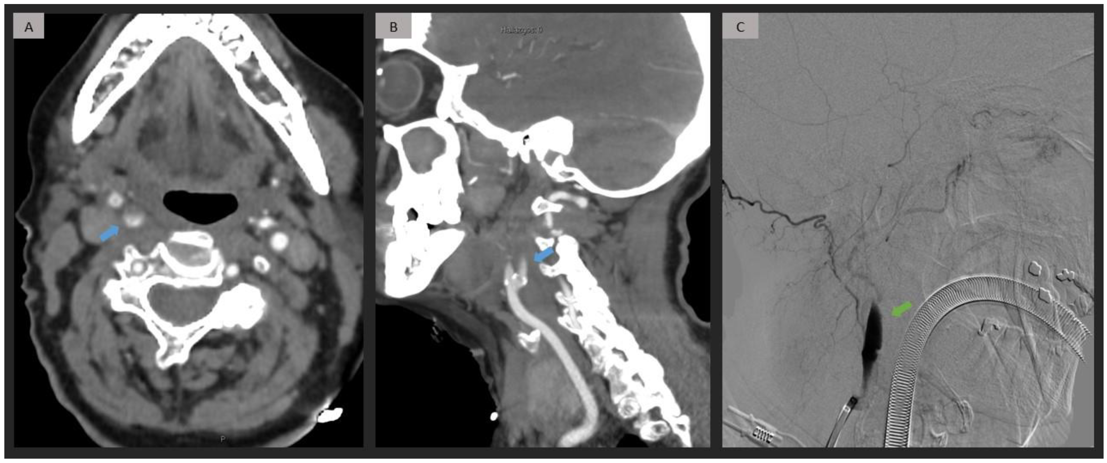 Jpm 13 01169 g001 Jpm 13 01169 g001