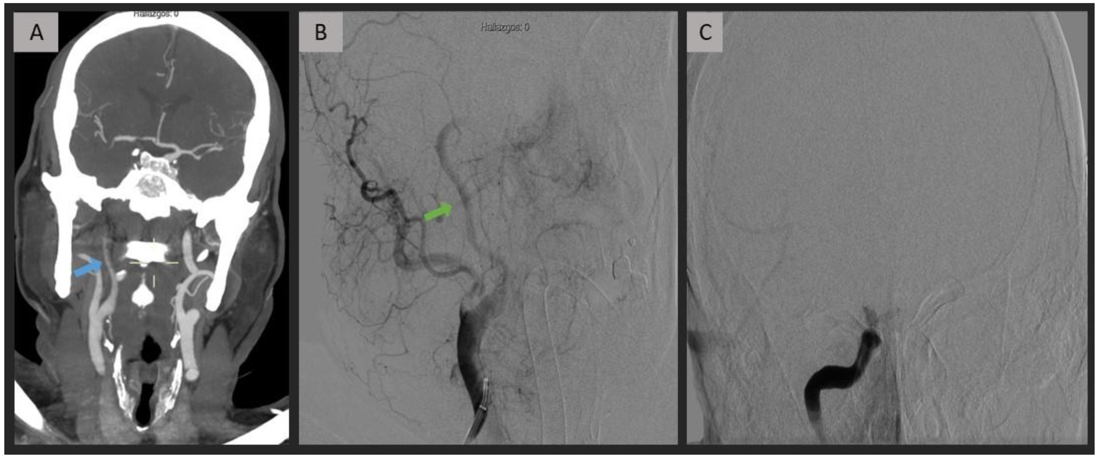 Jpm 13 01169 g002 Jpm 13 01169 g002