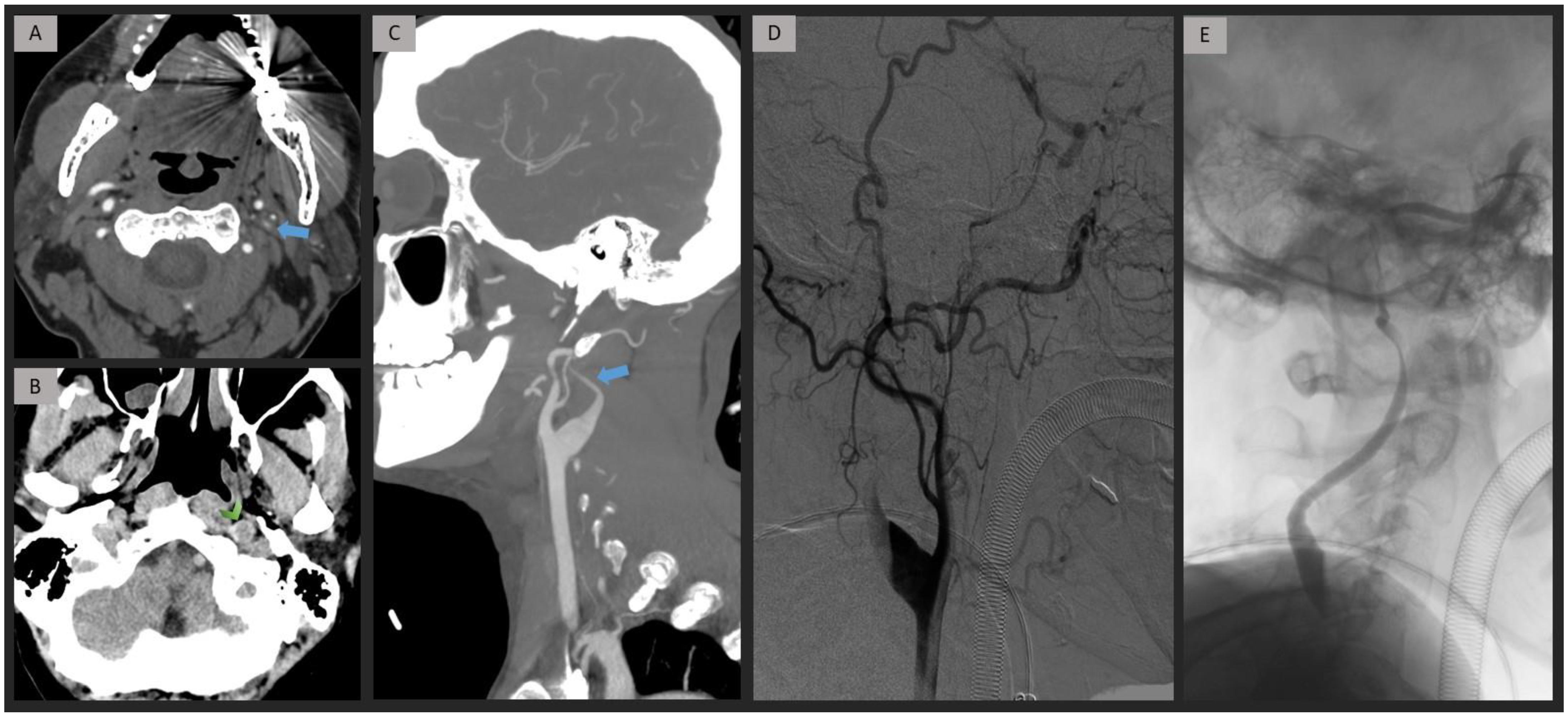 Jpm 13 01169 g004 Jpm 13 01169 g004