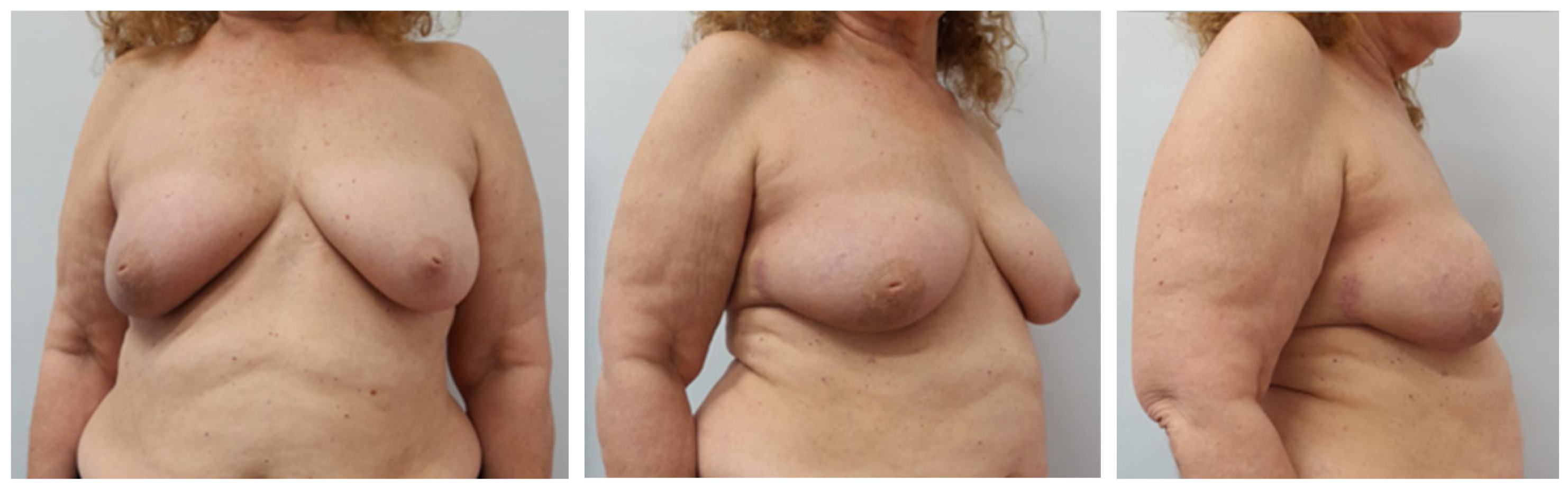 Jpm 15 00491 g003 Jpm 15 00491 g003