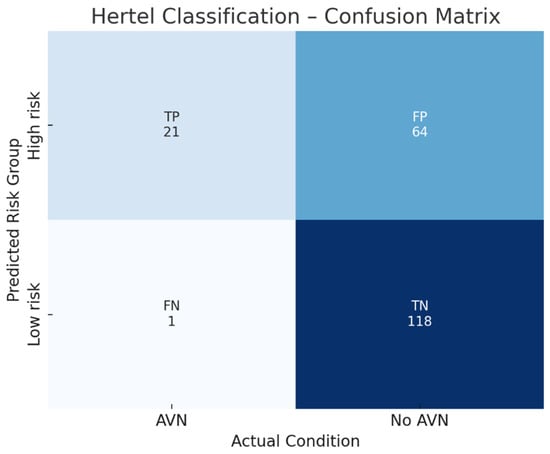 Confusion matrix illustrating the diagnostic performance of Hertel’s classification for predicting humeral head avascular necrosis (AVN) in elderly patients with intracapsular proximal humerus fractures. The model showed a sensitivity of 88%, specificity of 72%, positive predictive value (PPV) of 68%, negative predictive value (NPV) of 92%, and overall accuracy of 79%, confirming its high ability to identify patients at low ischemic risk.