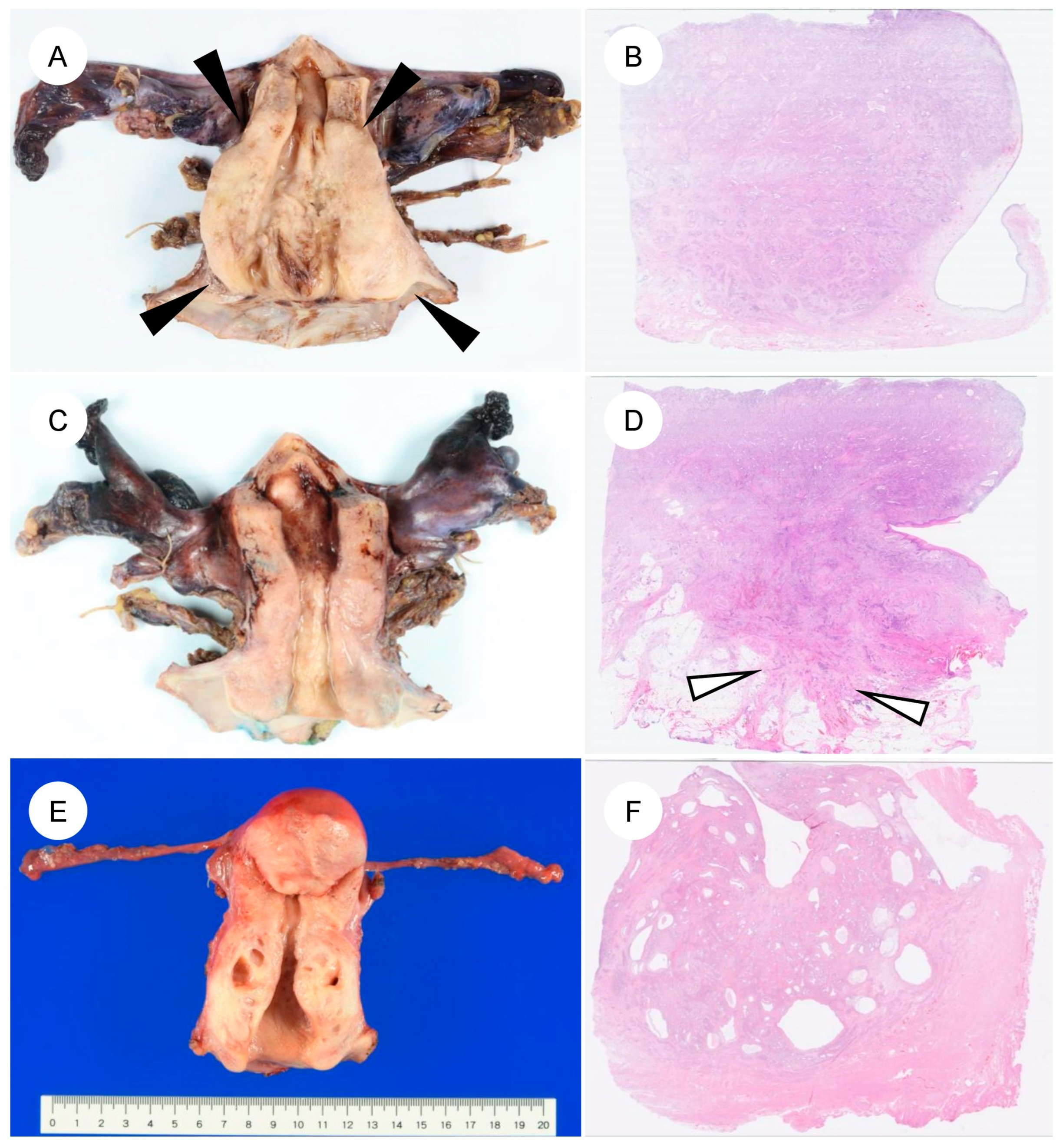 Jpm 16 00072 g002 Jpm 16 00072 g002