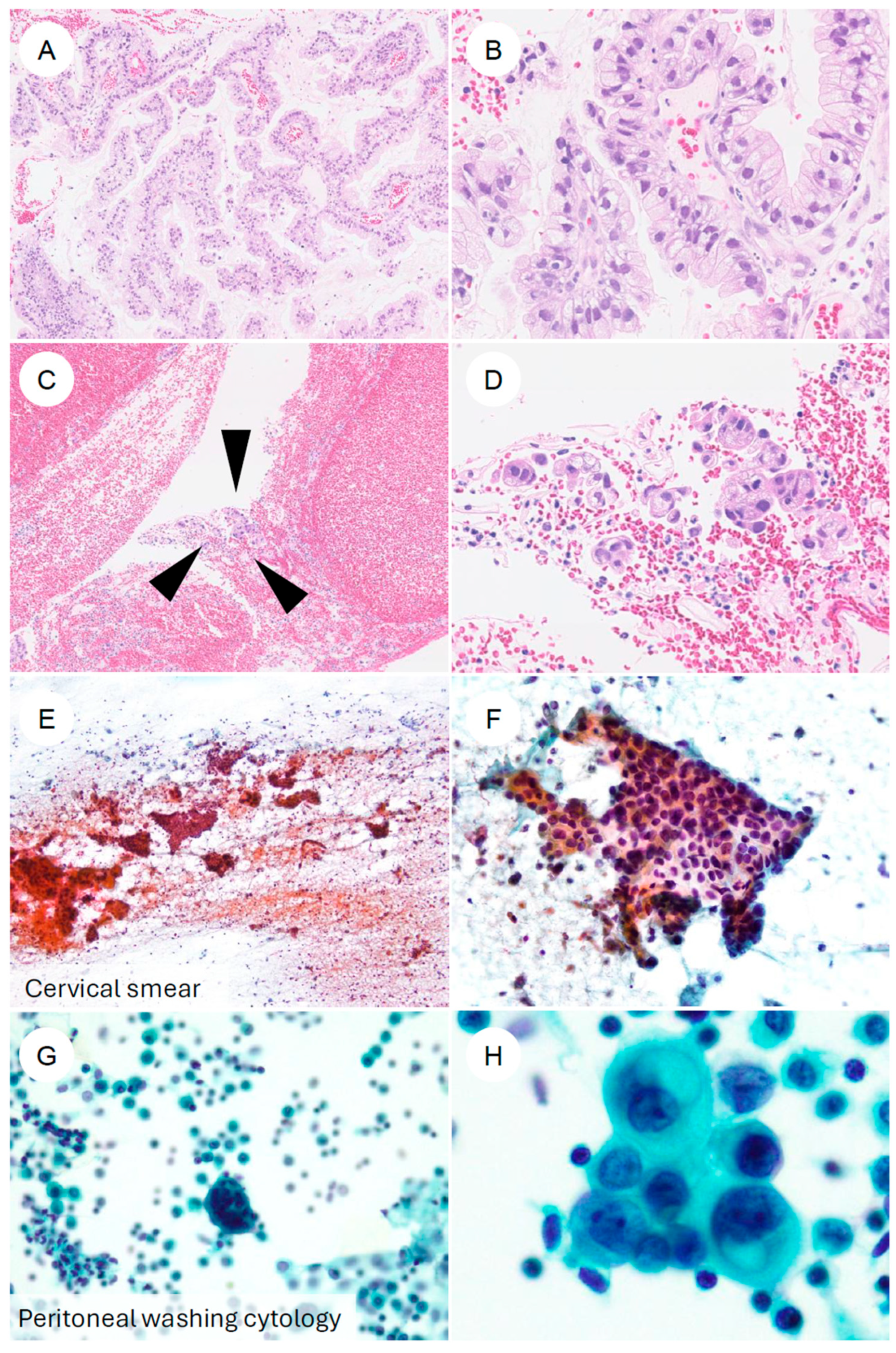 Jpm 16 00072 g005 Jpm 16 00072 g005