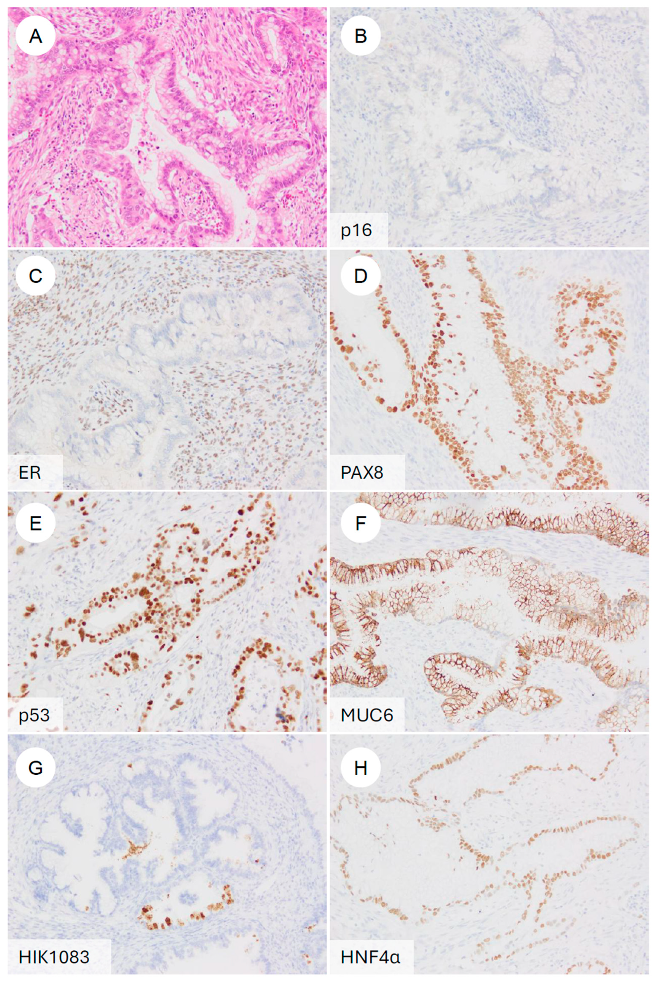 Jpm 16 00072 g006 Jpm 16 00072 g006