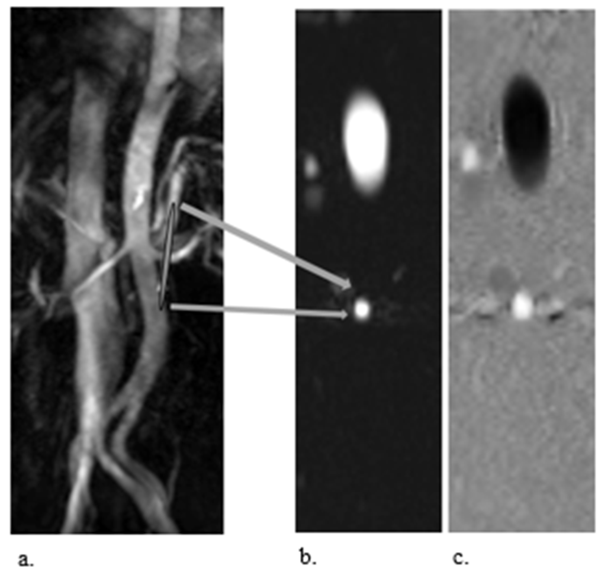 Kidneydial 02 00036 g002