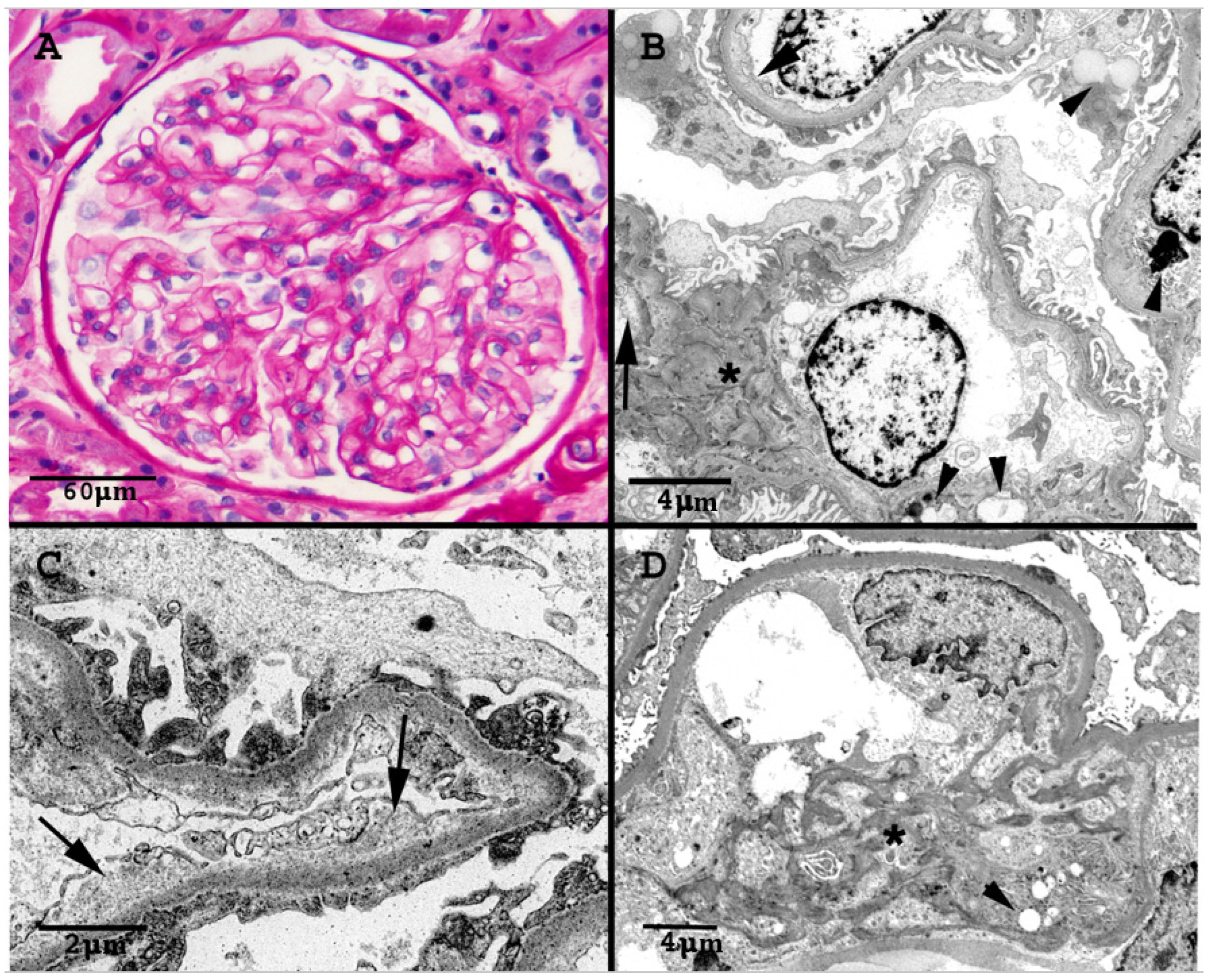 Kidneydial 02 00048 g002