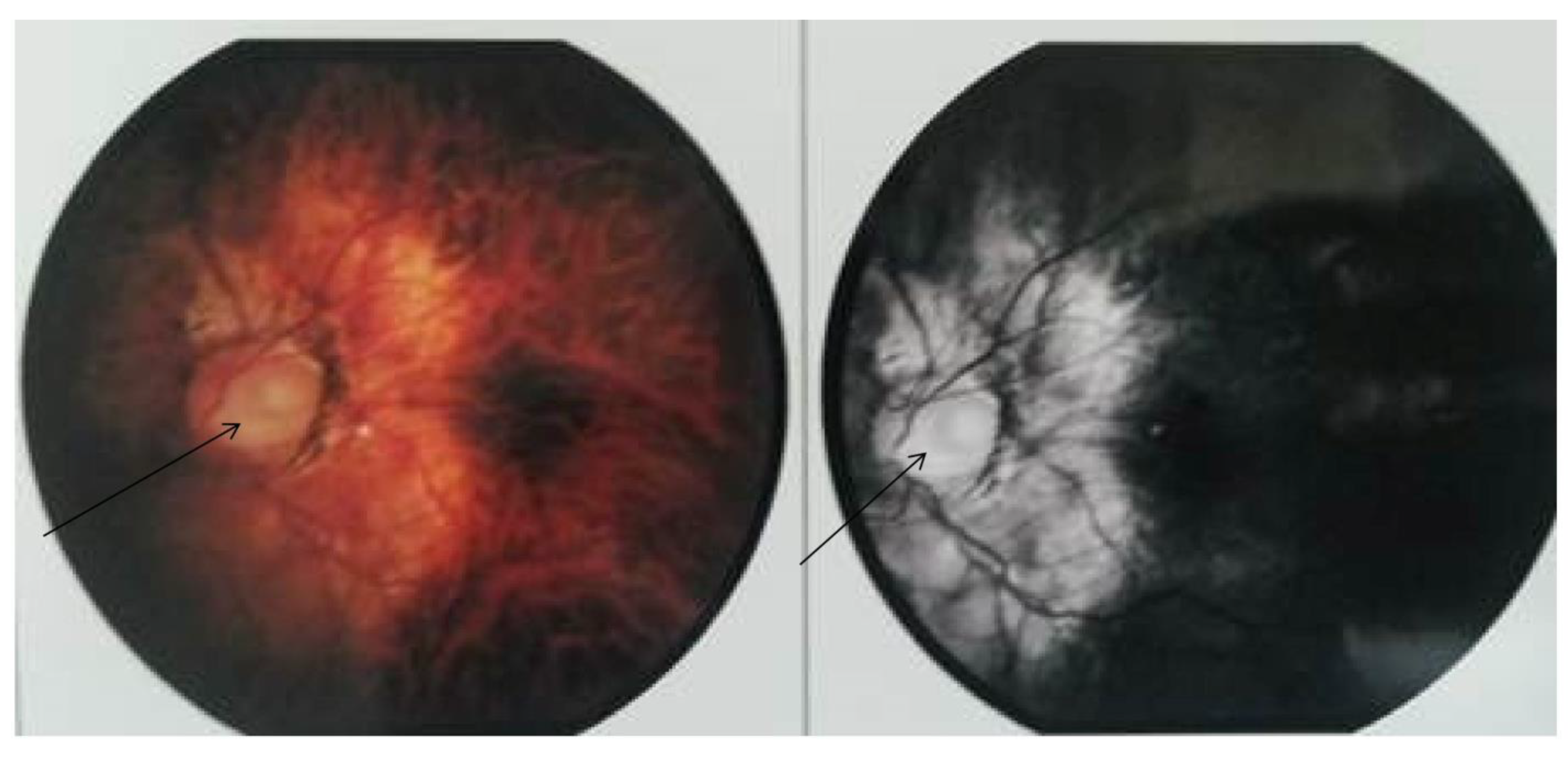 Kidneydial 03 00023 g002