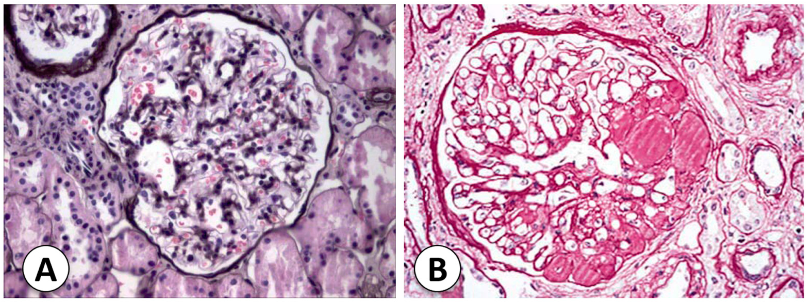 Kidneydial 03 00030 g002