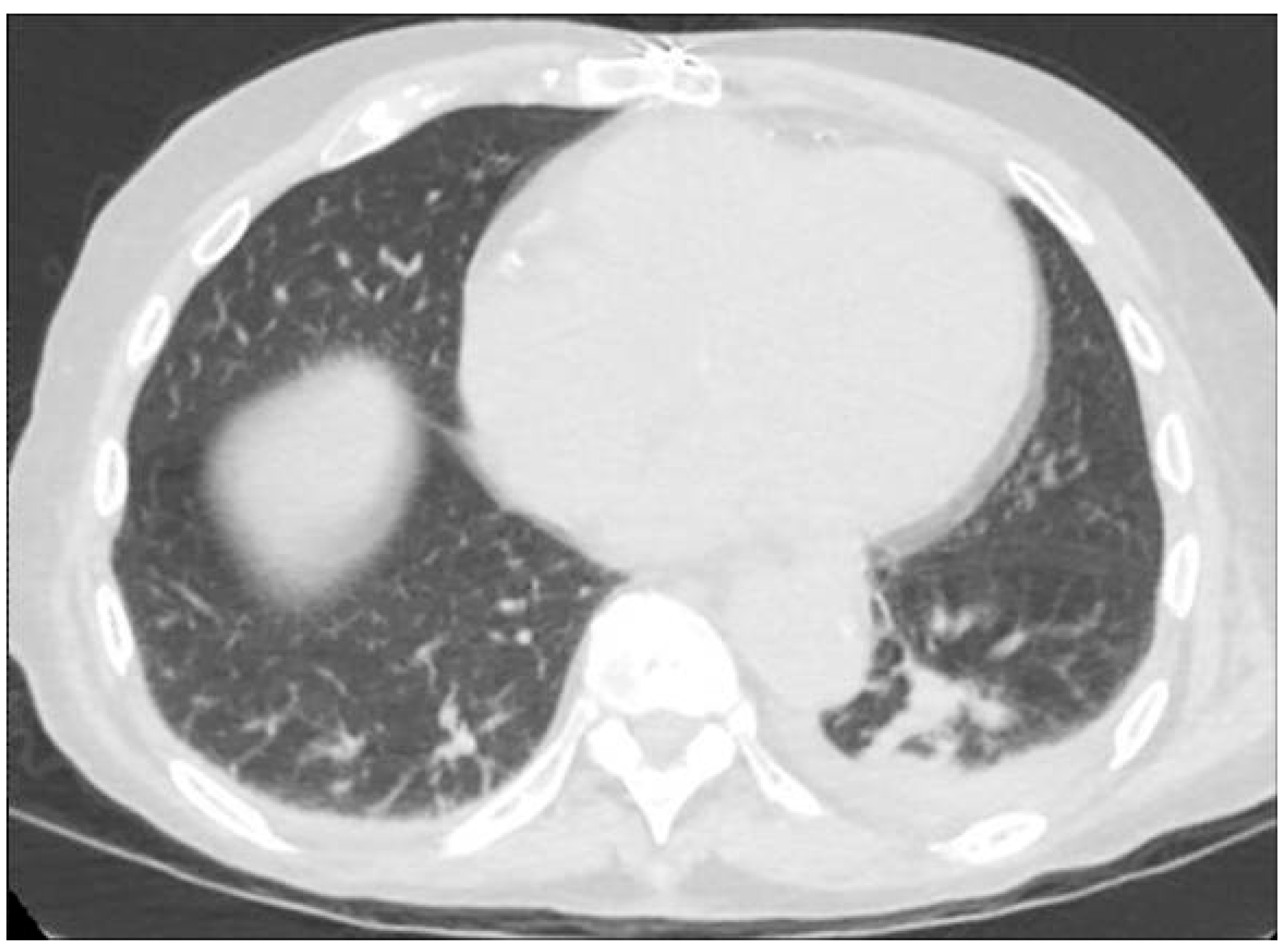 Kidneydial 05 00033 g001