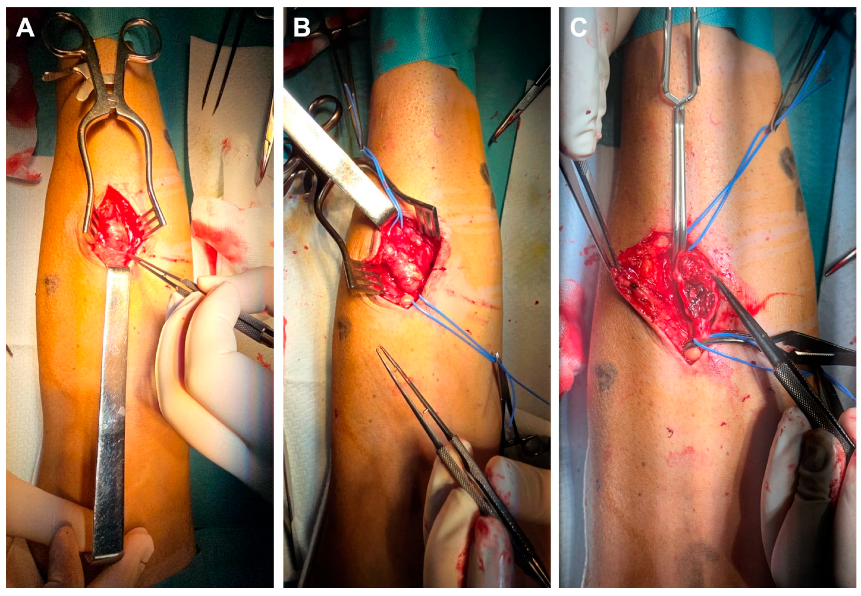 Kidneydial 05 00046 g001