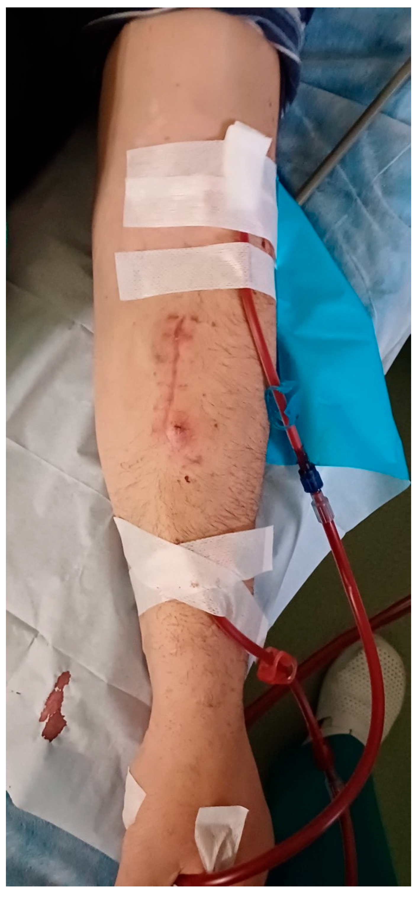 Kidneydial 05 00046 g004