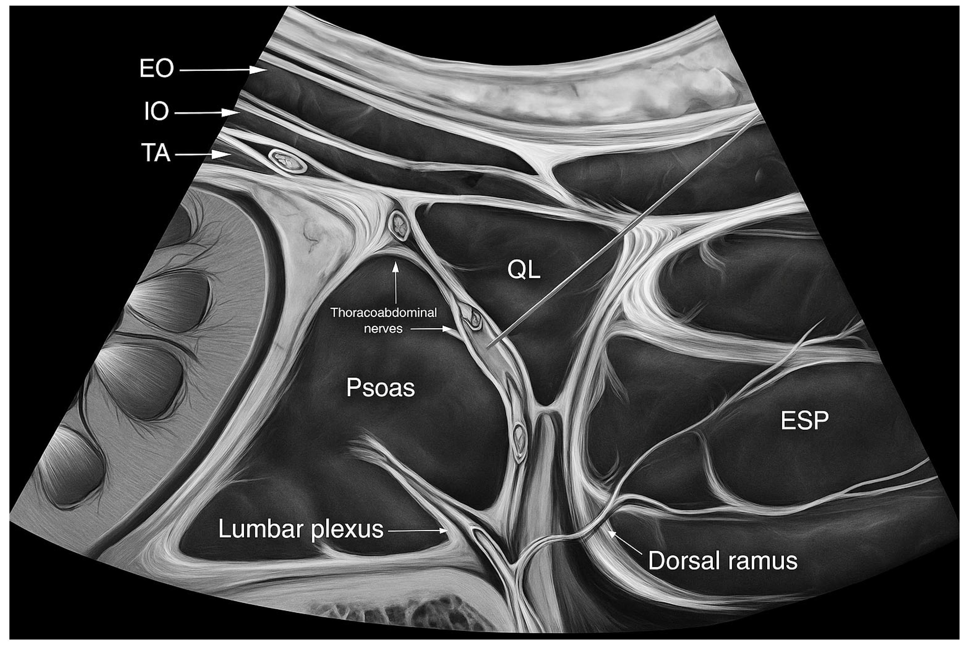 Kidneydial 05 00055 g001 Kidneydial 05 00055 g001