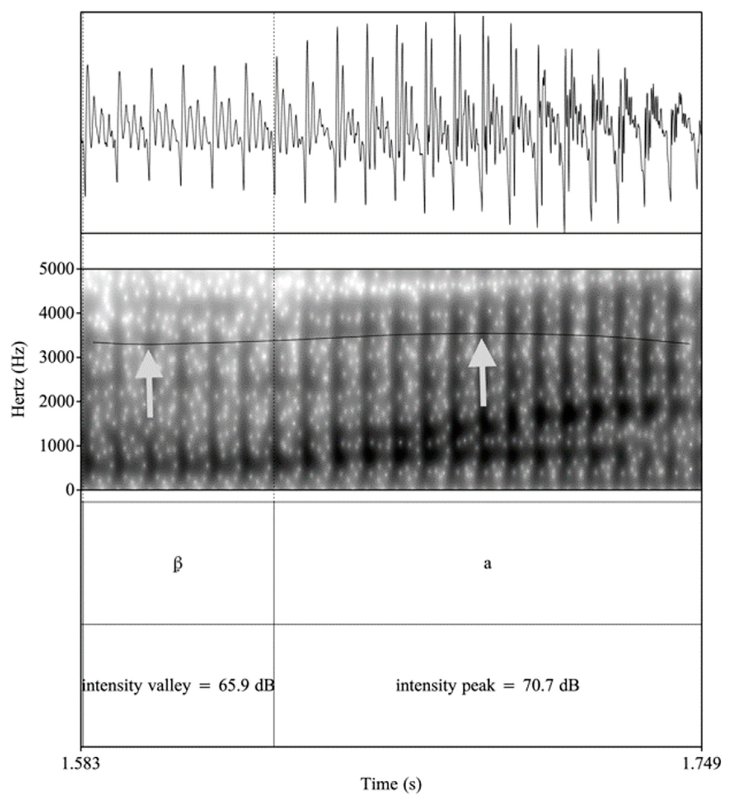 Languages 05 00072 g003 Languages 05 00072 g003