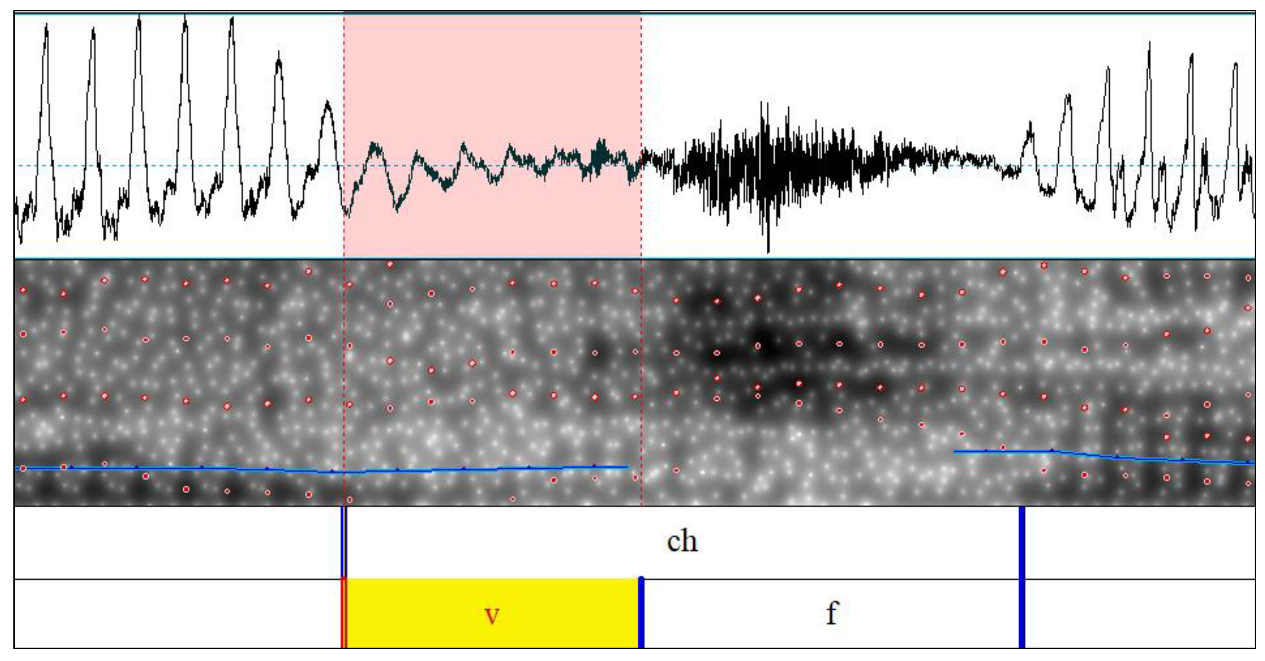 Languages 07 00101 g003 Languages 07 00101 g003