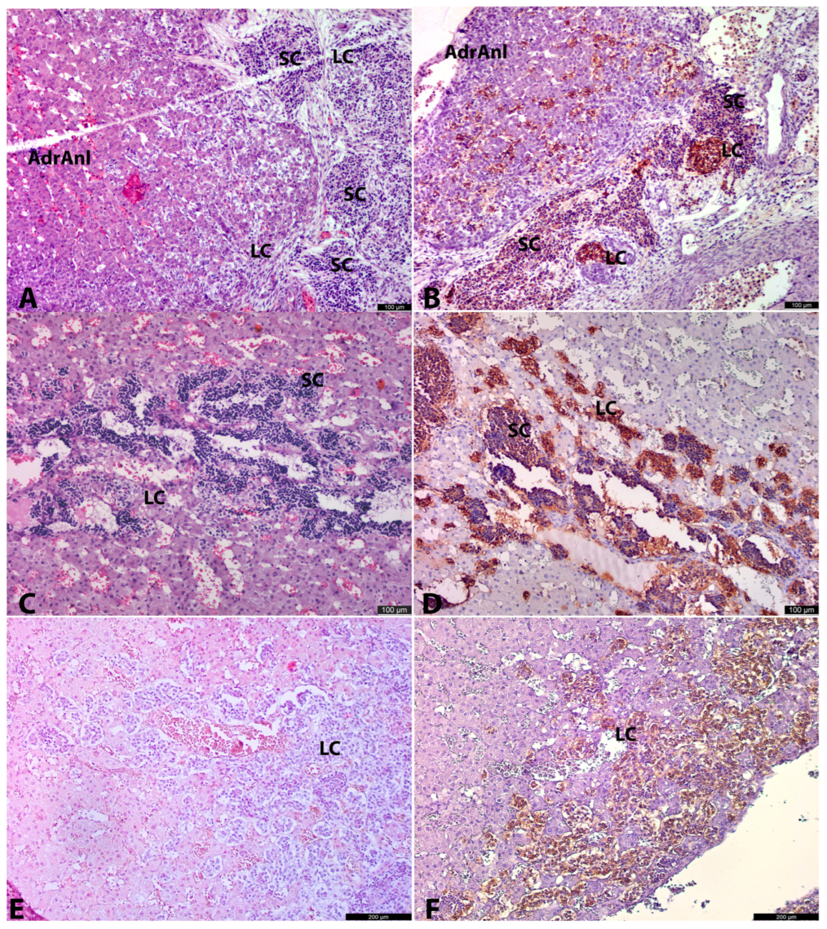 Developmental Parallels Between the Human Organs of Zuckerkandl and ...