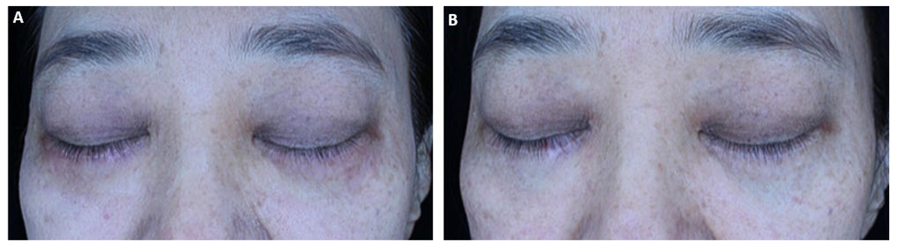 Life 16 00217 g003 Life 16 00217 g003