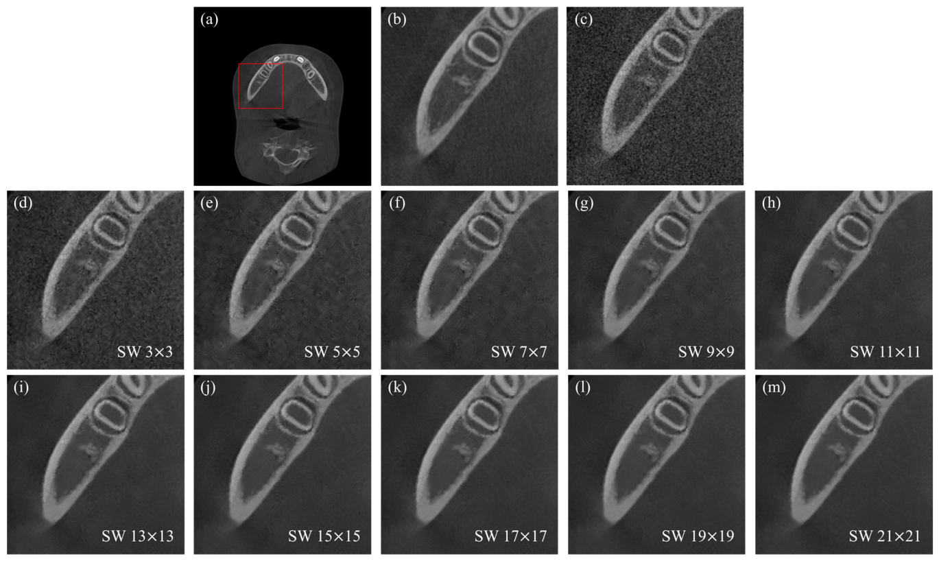 Mandible-Specific Noise Reduction in Pediatric Dental CBCT with ...