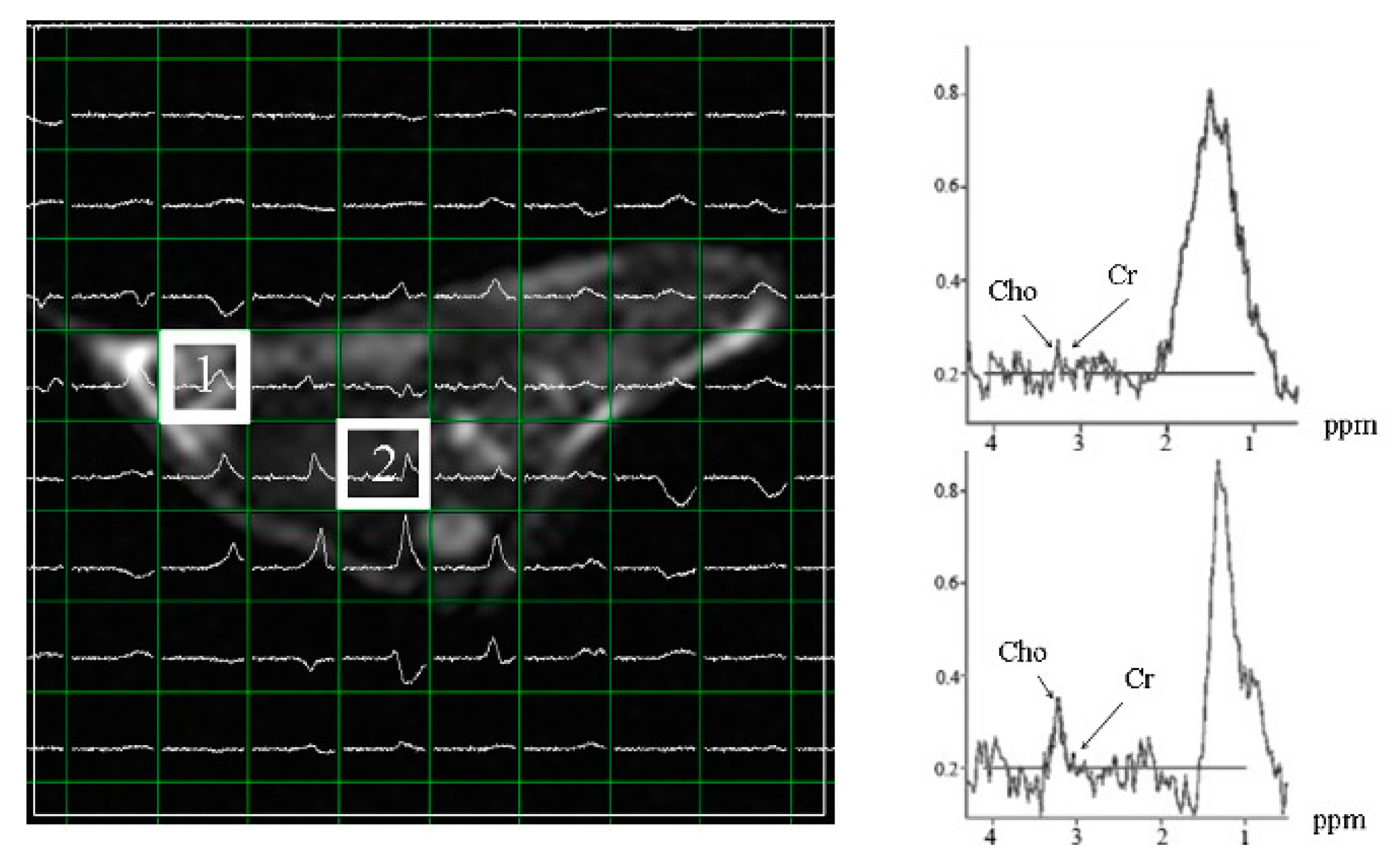 Livers 02 00030 g005
