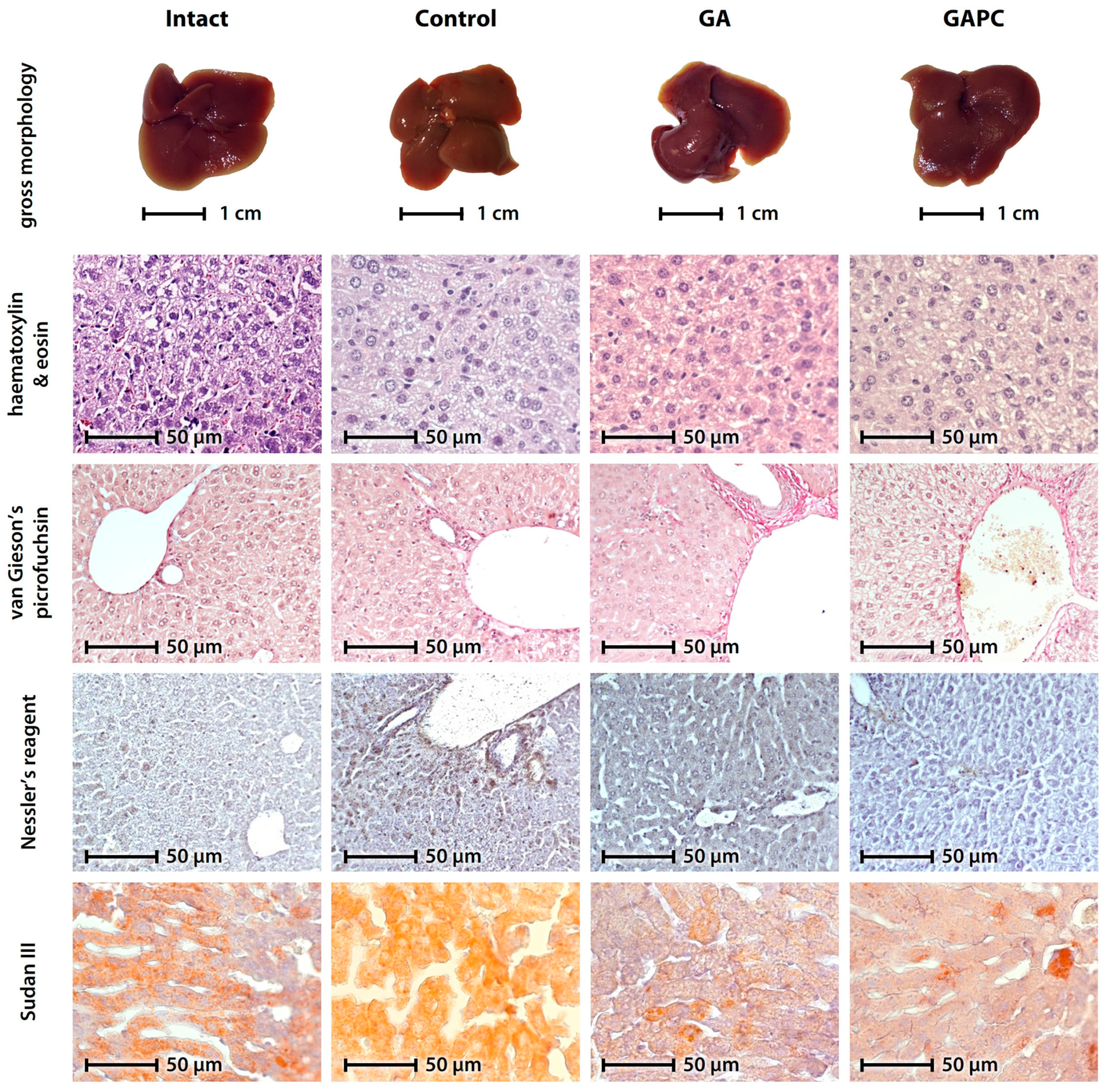 Livers 04 00006 g001 Livers 04 00006 g001