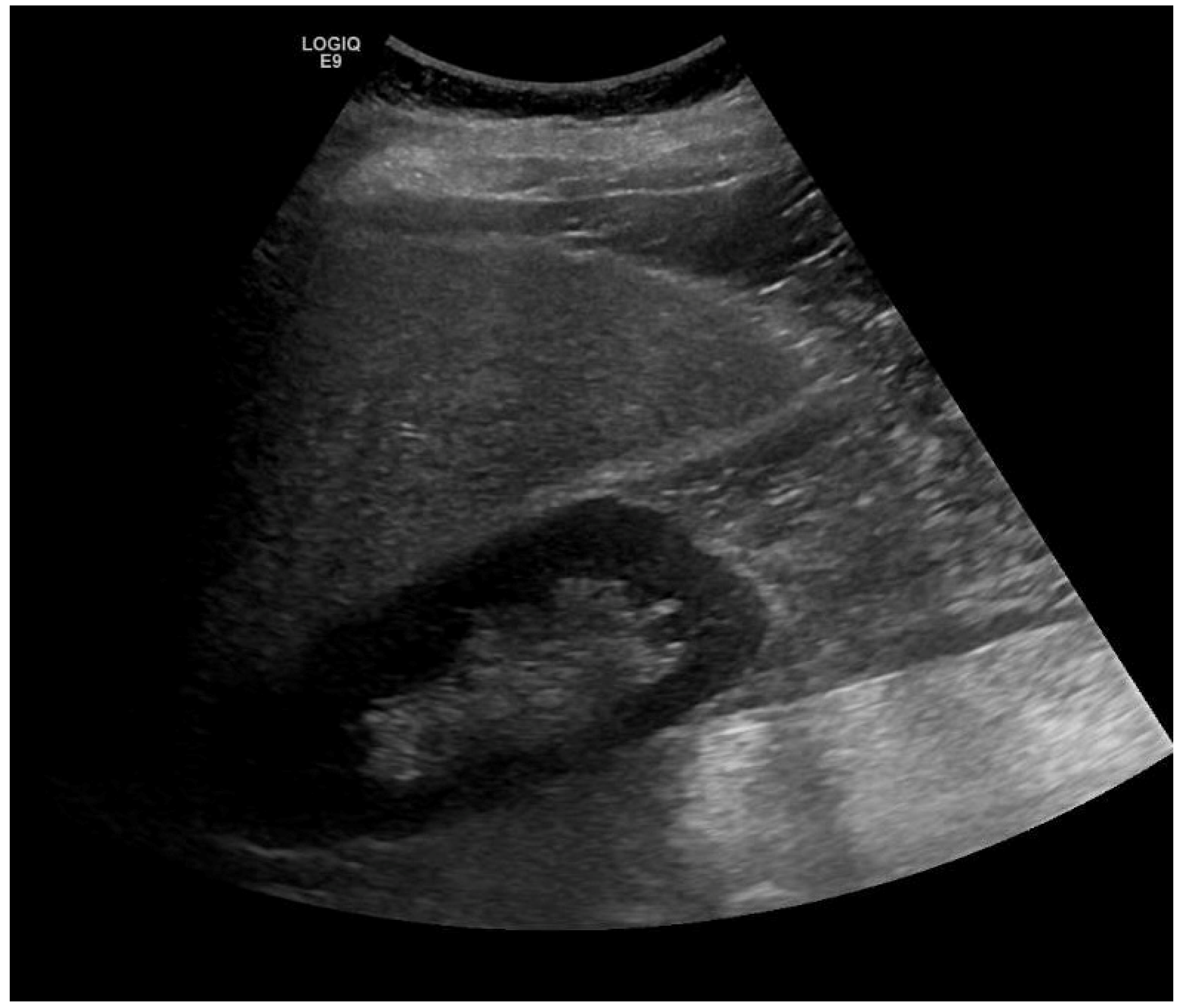 Livers 04 00012 g001