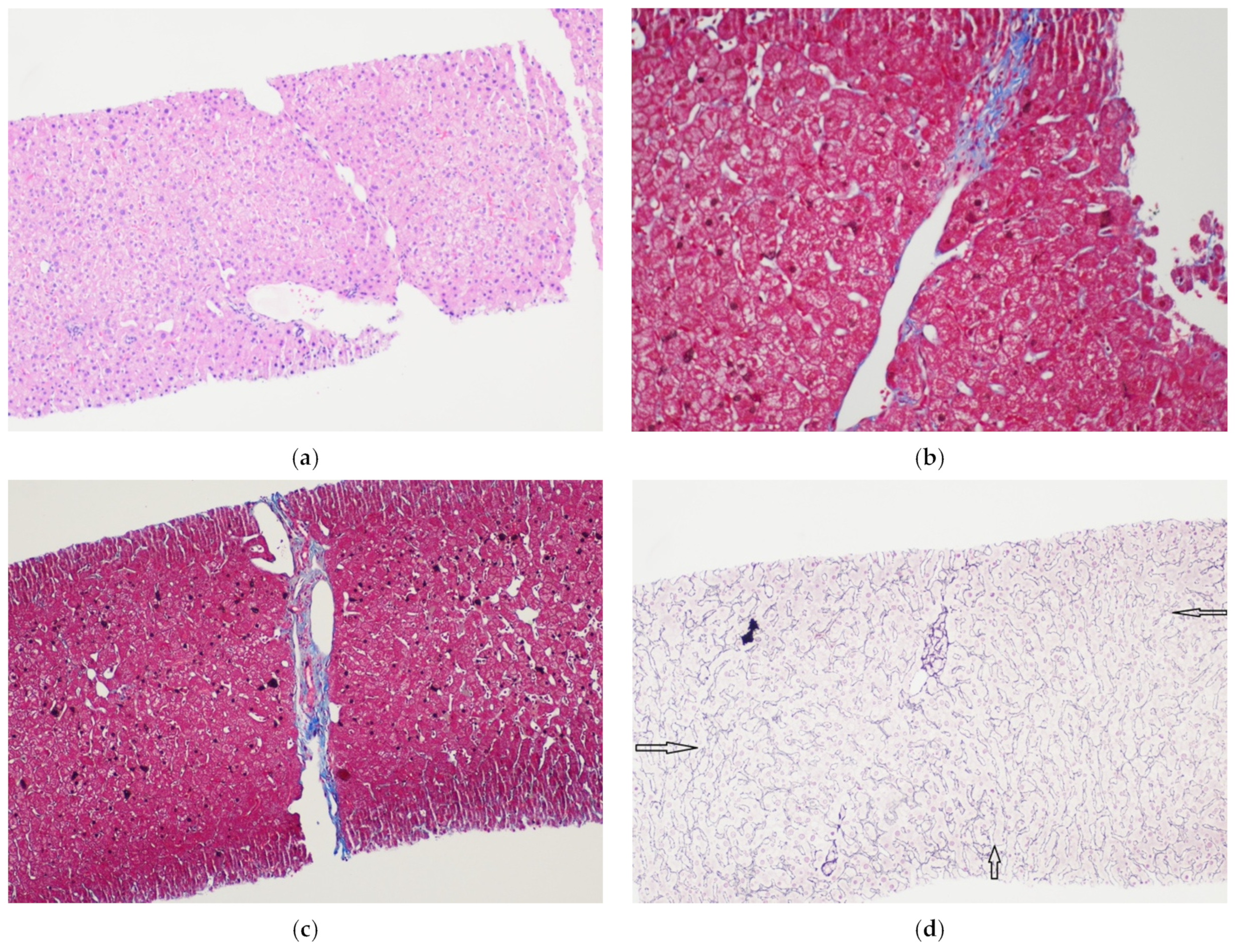 Livers 04 00022 g002