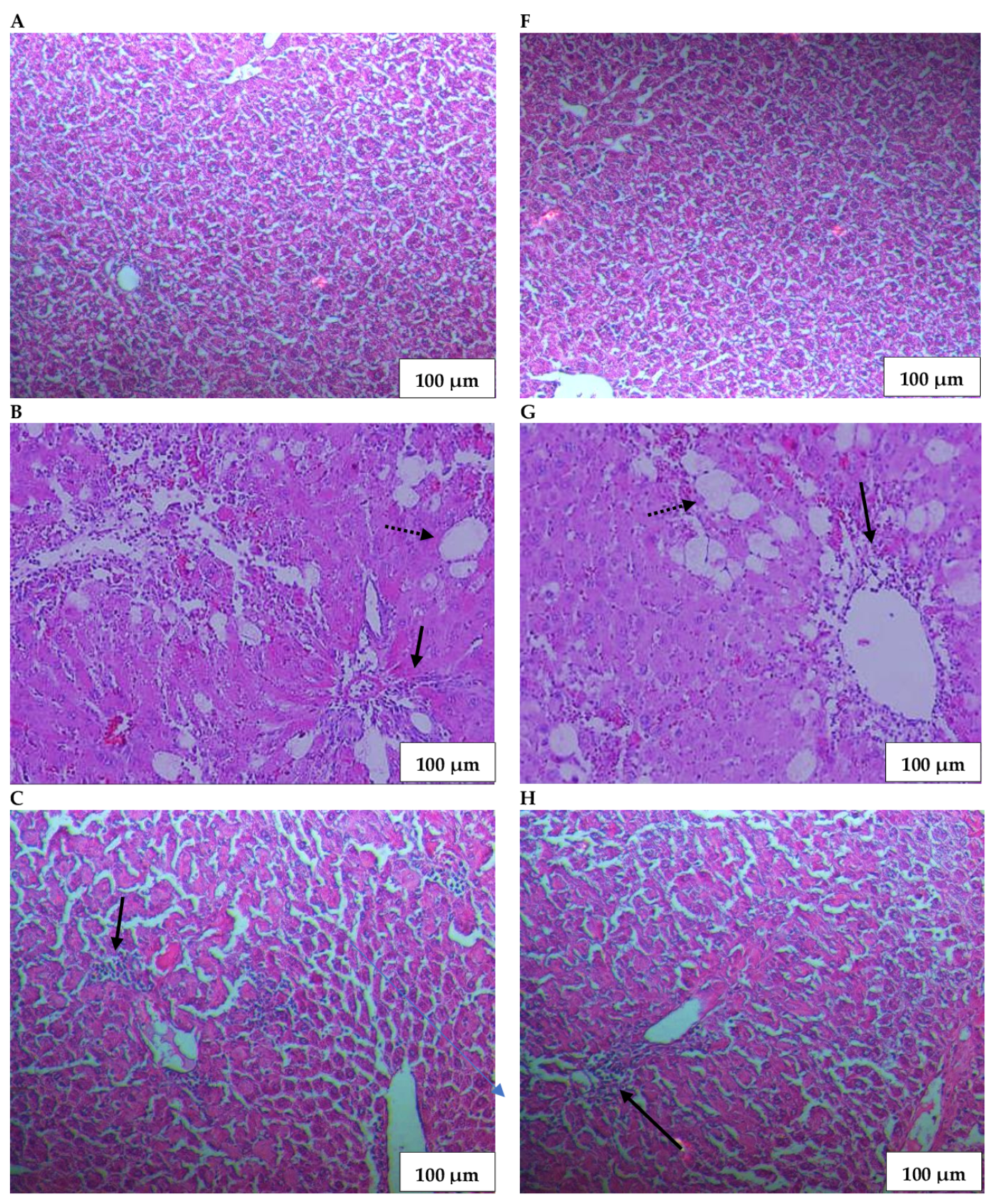 Livers 04 00048 g003a