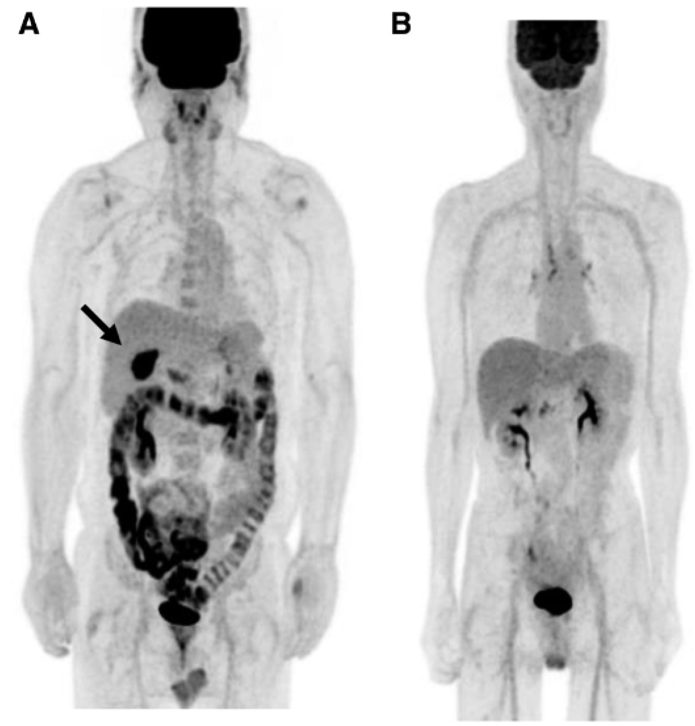 Livers 05 00035 g002