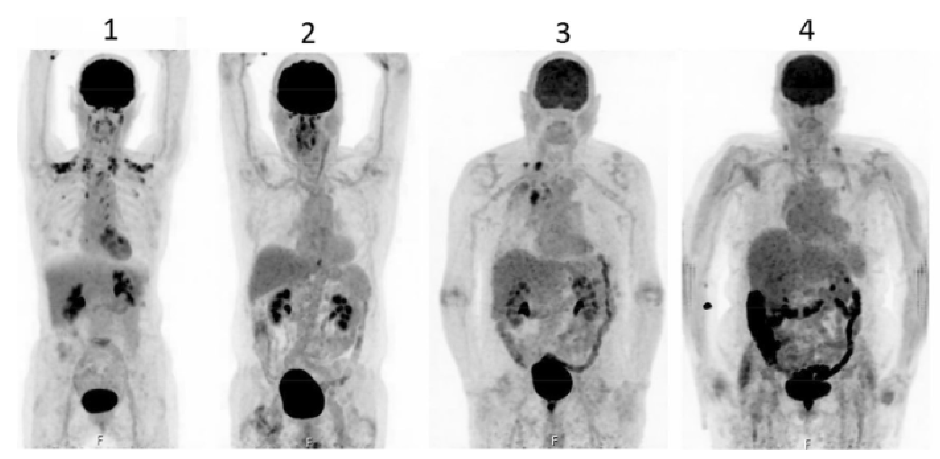 Livers 05 00035 g003