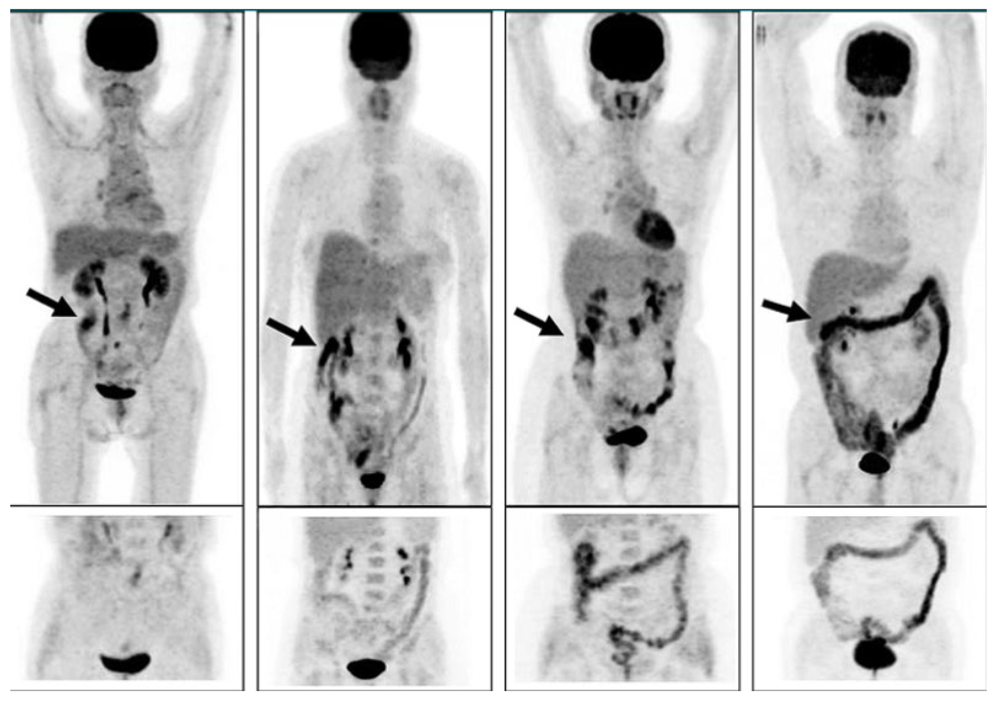 Livers 05 00035 g004