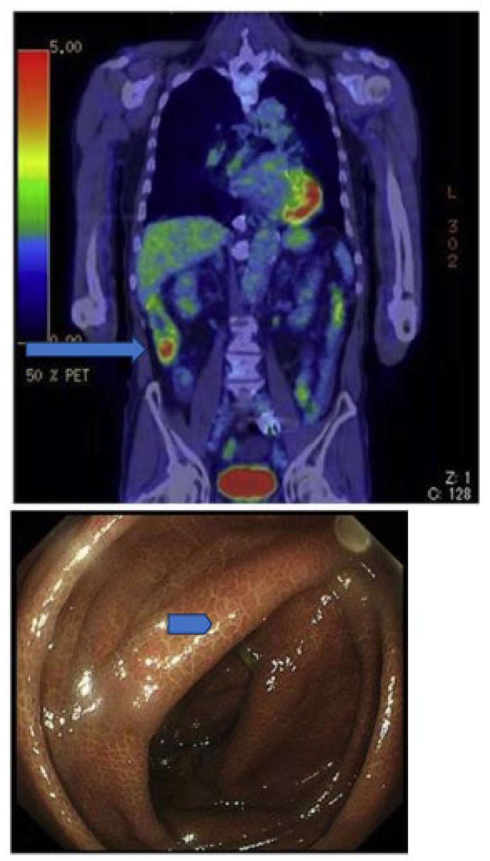 Livers 05 00035 g005