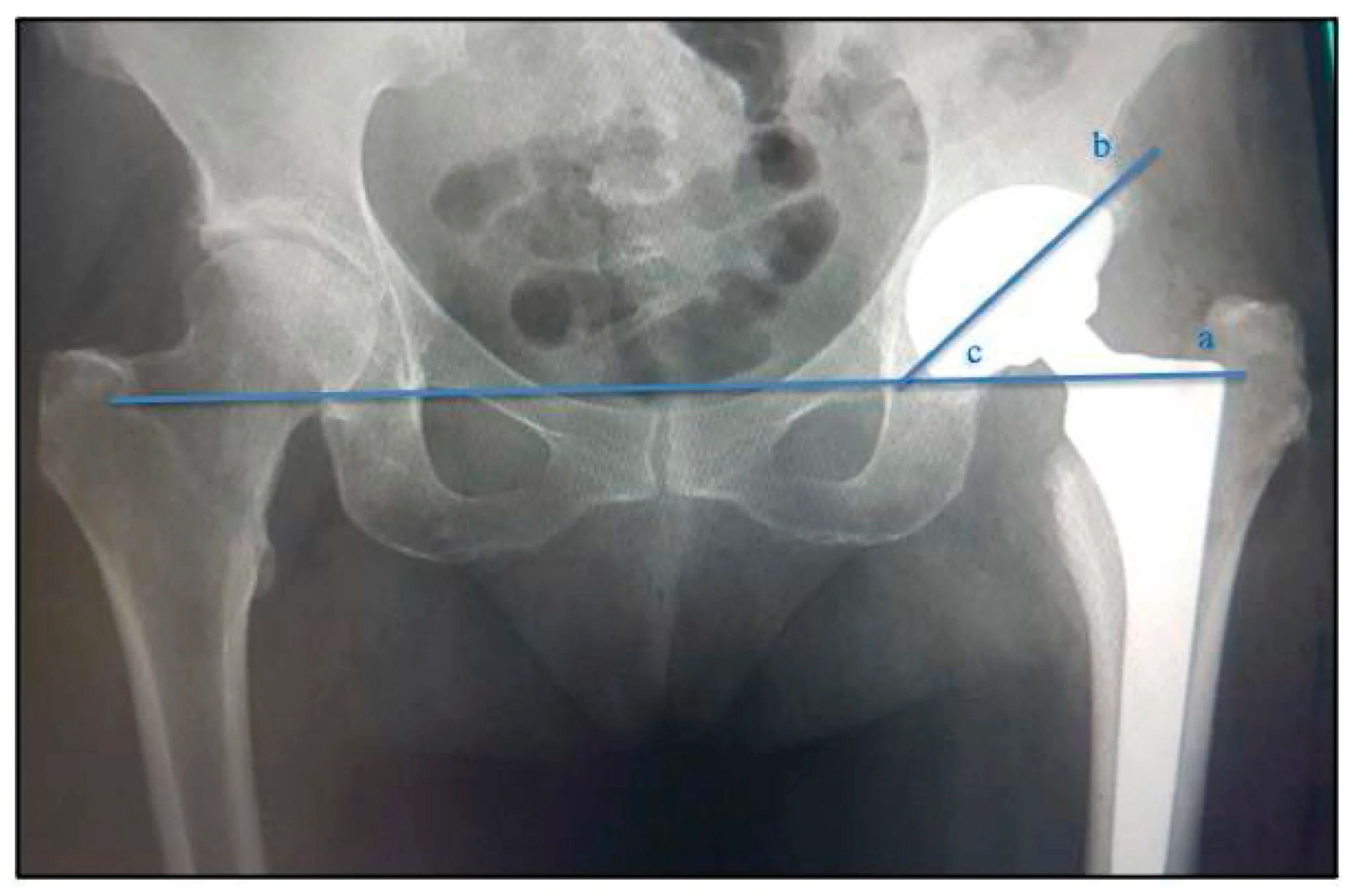 Lubricants 14 00036 g002 Lubricants 14 00036 g002
