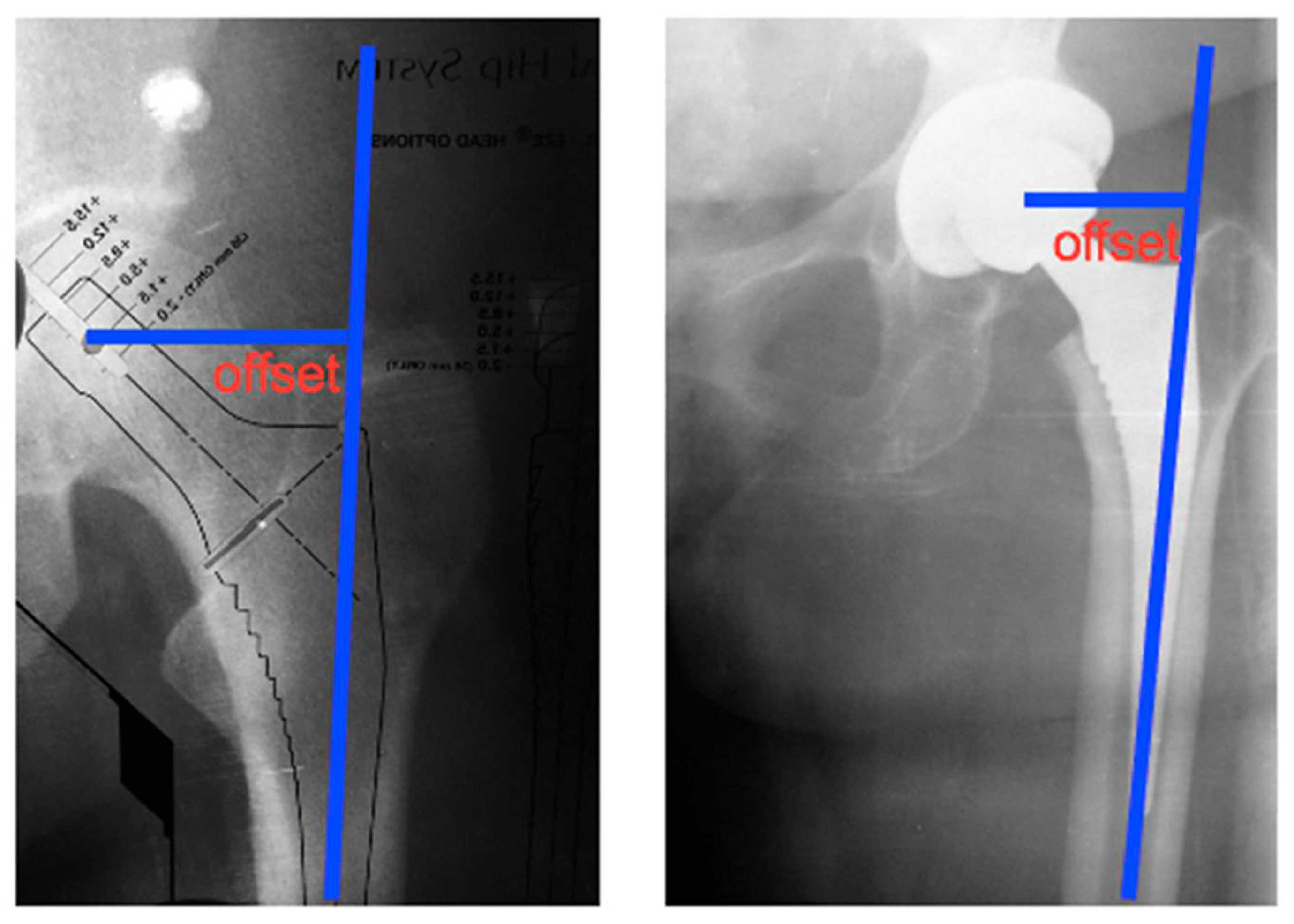 Lubricants 14 00036 g004 Lubricants 14 00036 g004