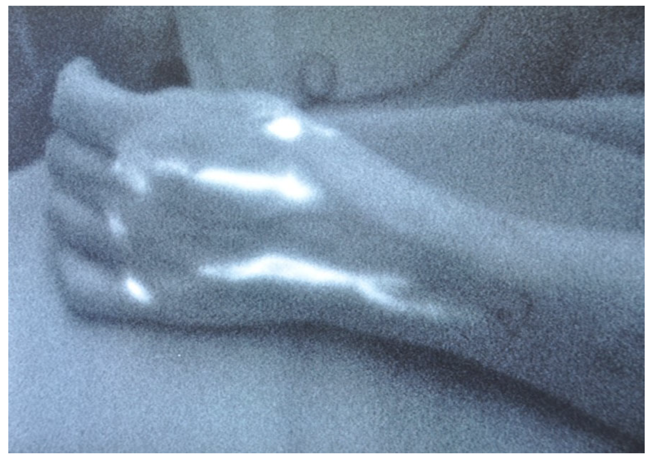 Lymphatics 01 00013 g002