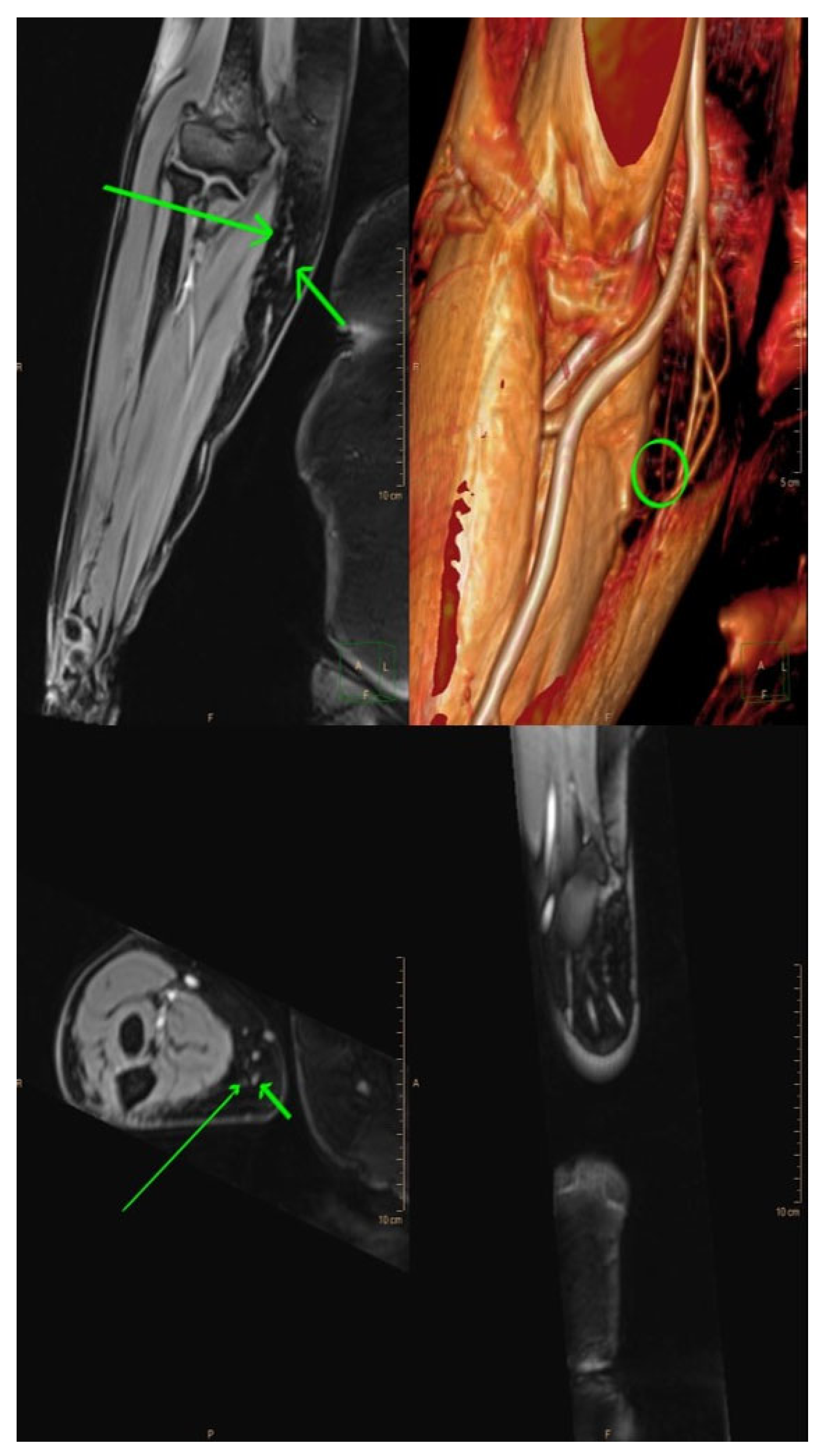 Lymphatics 01 00013 g003