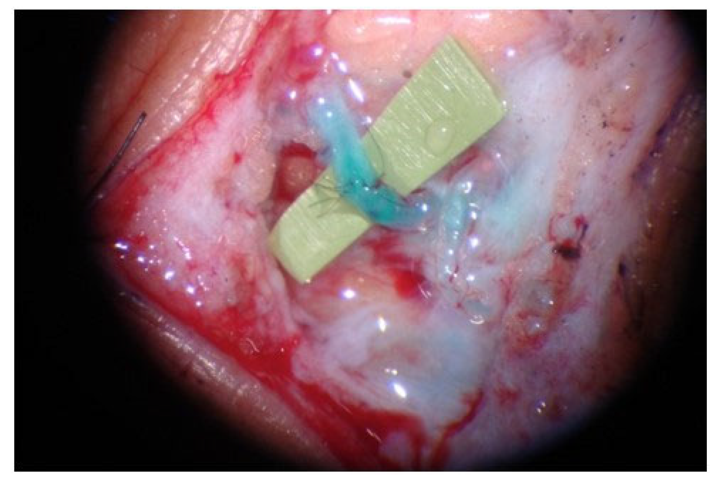 Lymphatics 01 00013 g004